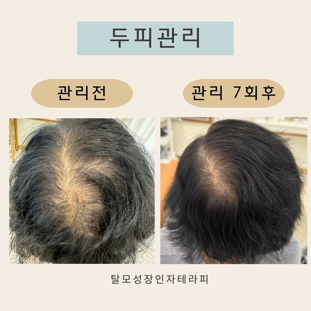 결고은 뷰티