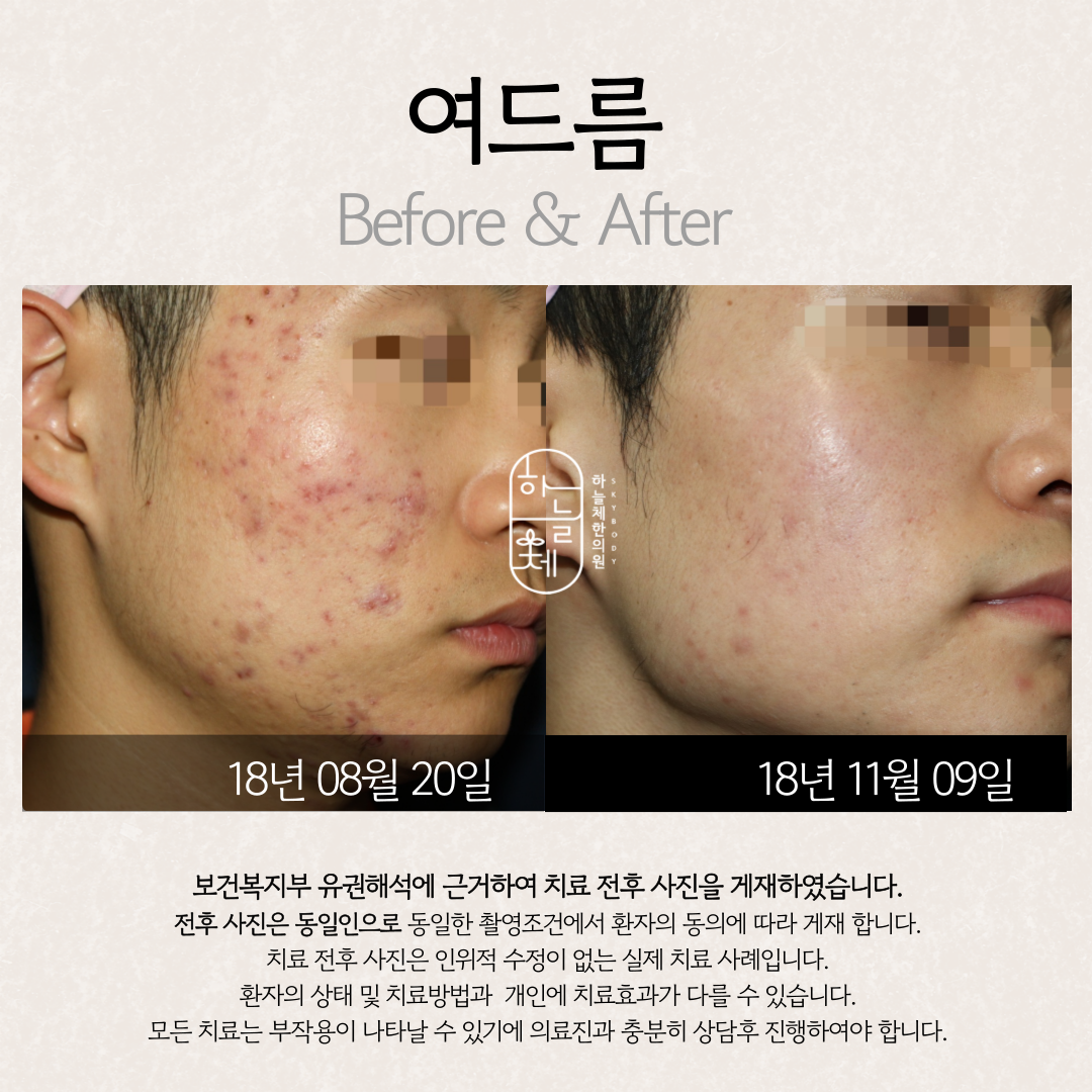 하늘체한의원 대구 대표 이미지