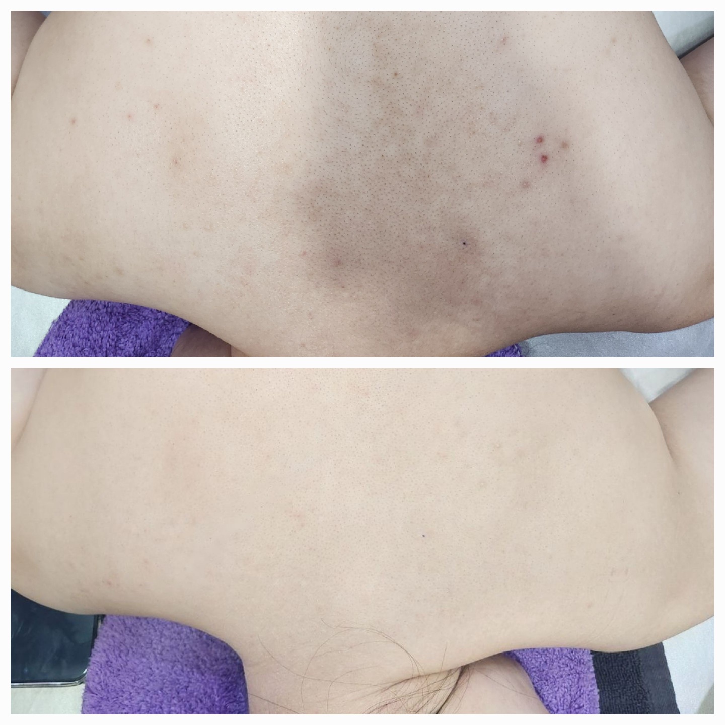 채움피부연구소 동탄본점 대표 이미지