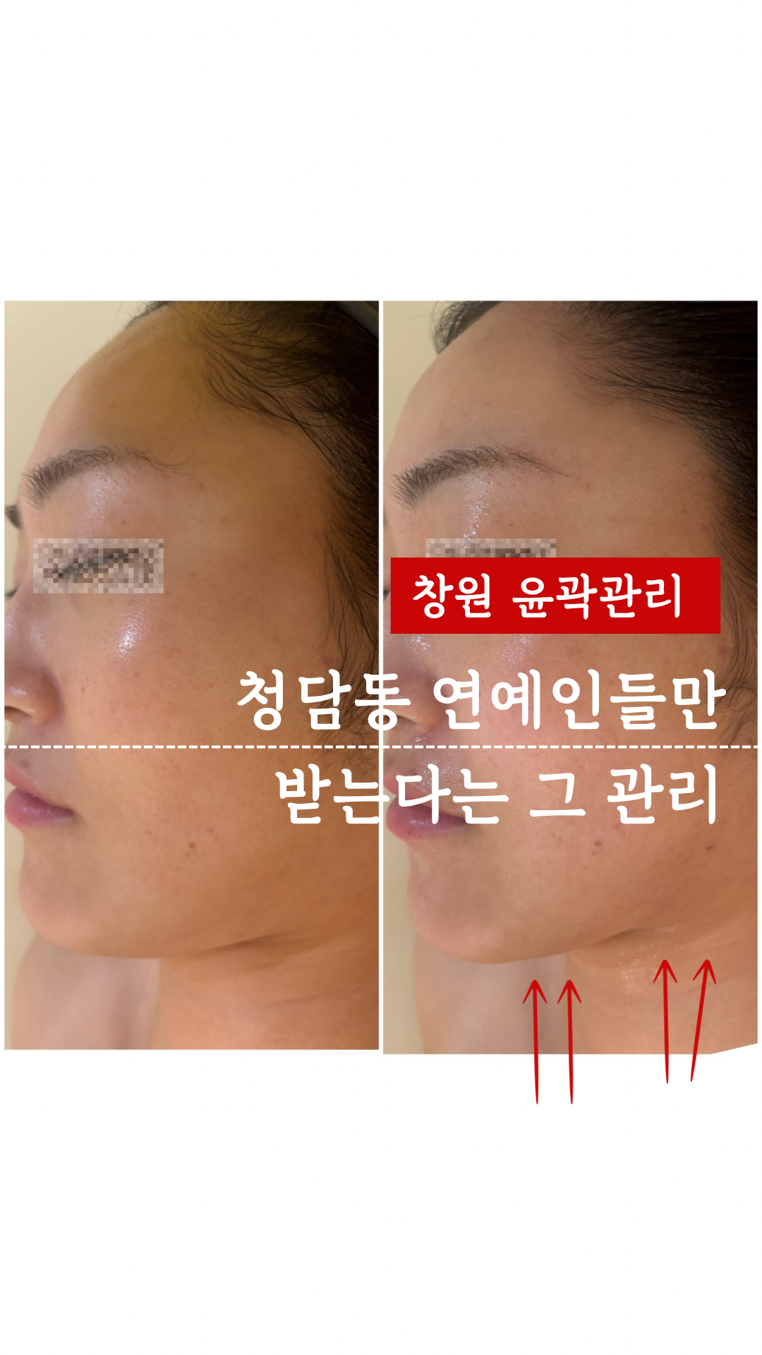 샤비에스테틱 창원점 대표 이미지