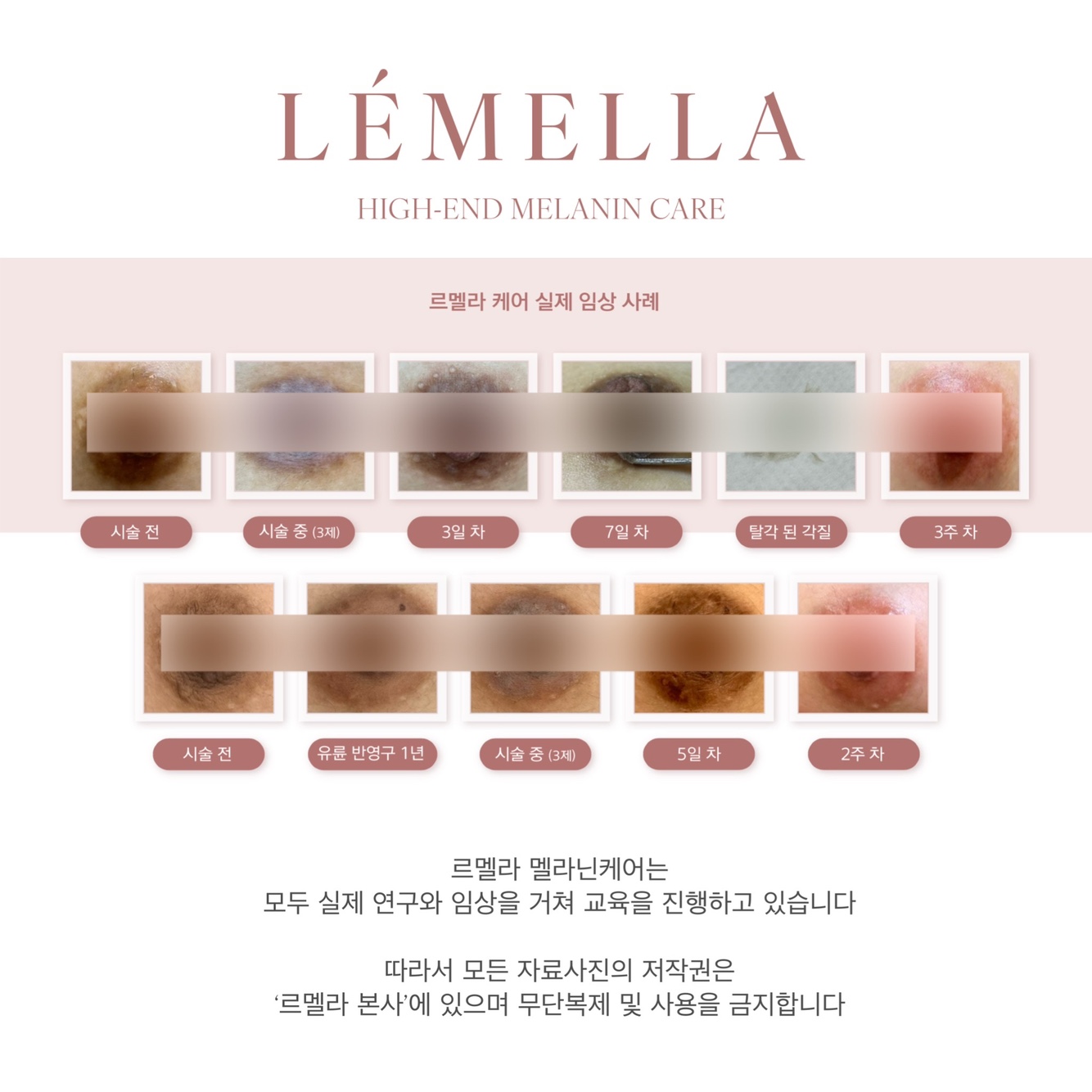 벨레오뷰티 슈가링왁싱&속눈썹펌 건대점 대표 이미지