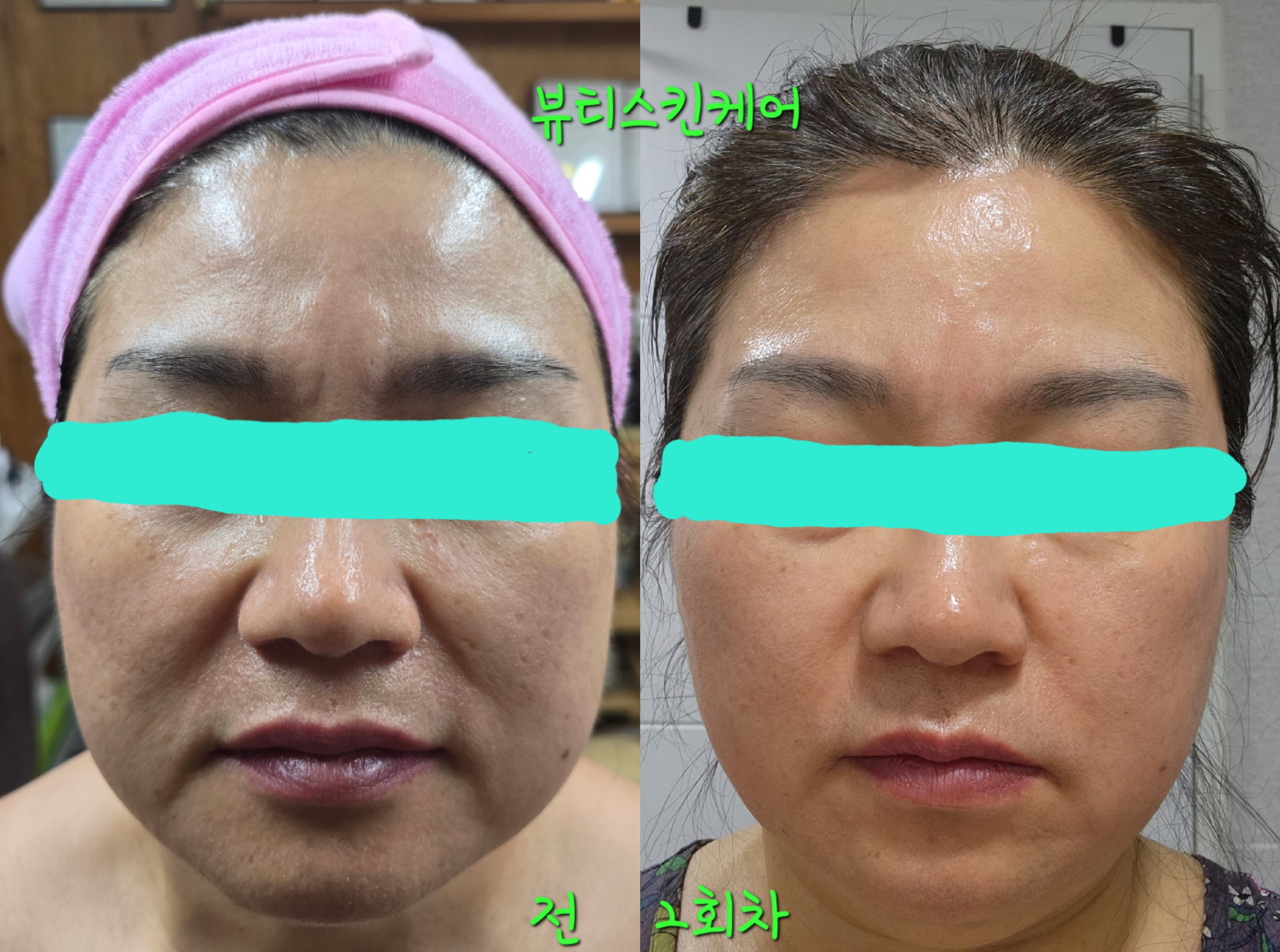 뷰티스킨케어 개봉동본점 대표 이미지