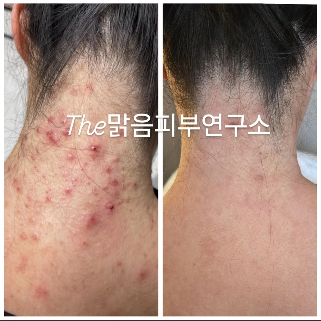 더맑음피부연구소 대표 이미지