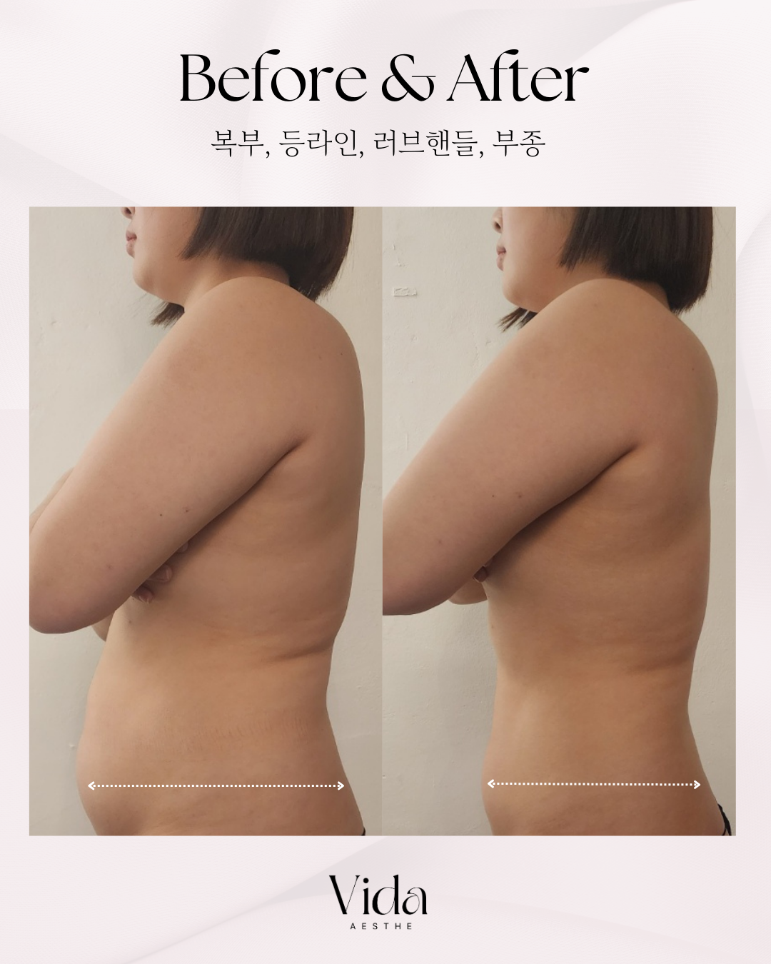 비다에스테 대표 이미지