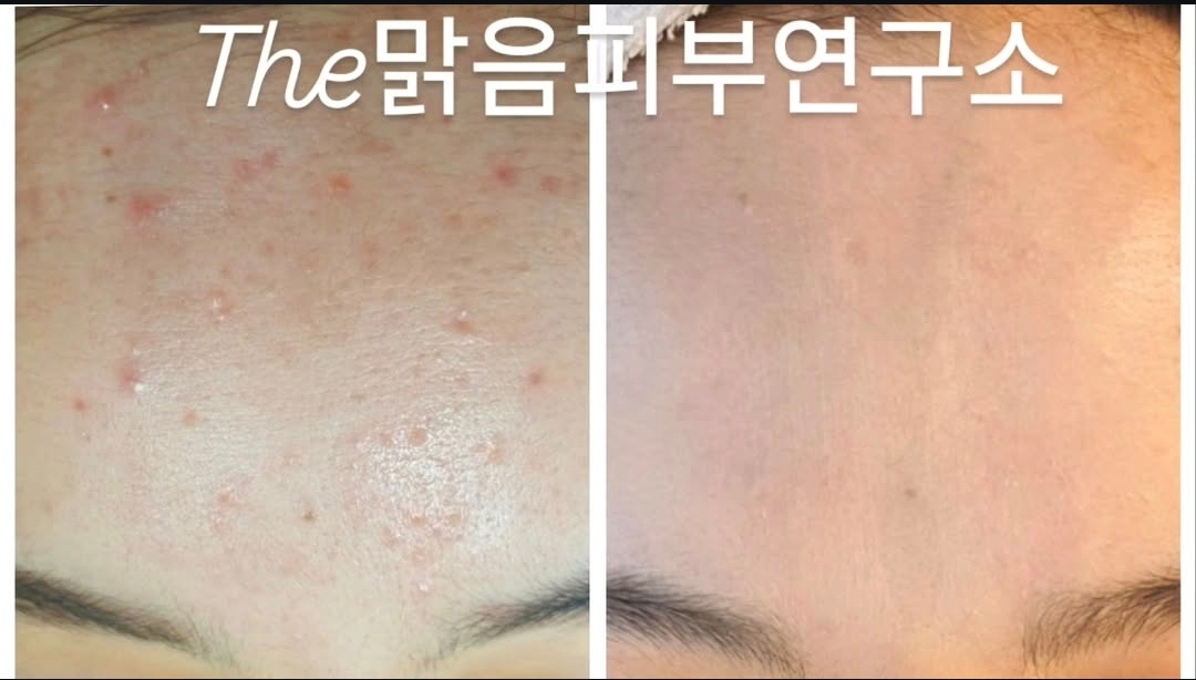 더맑음피부연구소 대표 이미지