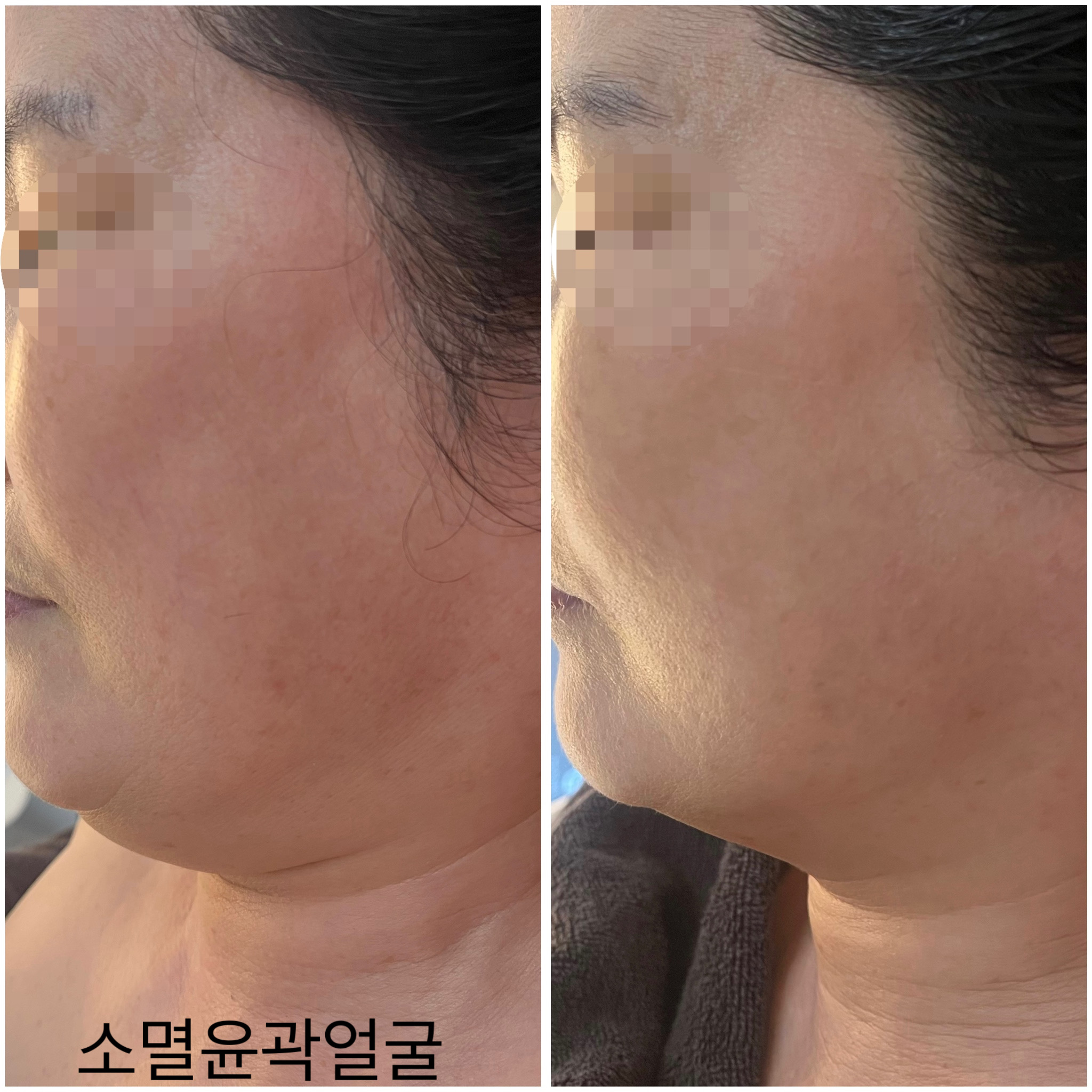 스와롭스킨 대표 이미지