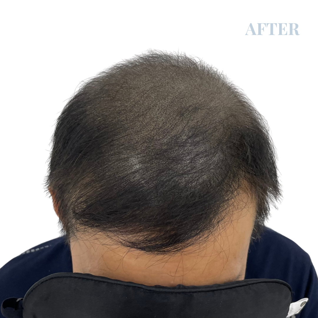 림스칼프 대구본점 대표 이미지