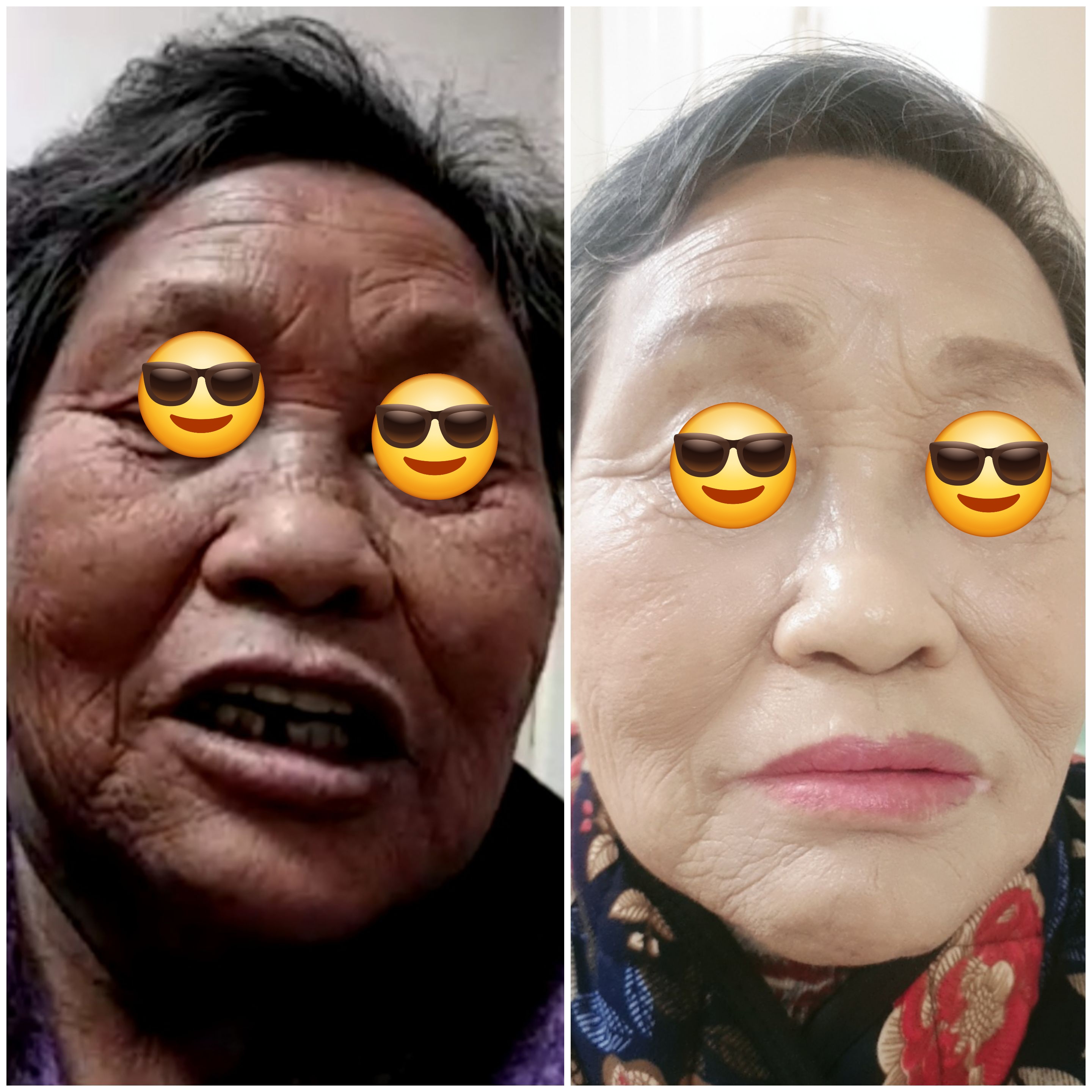 김나윤 피부샵