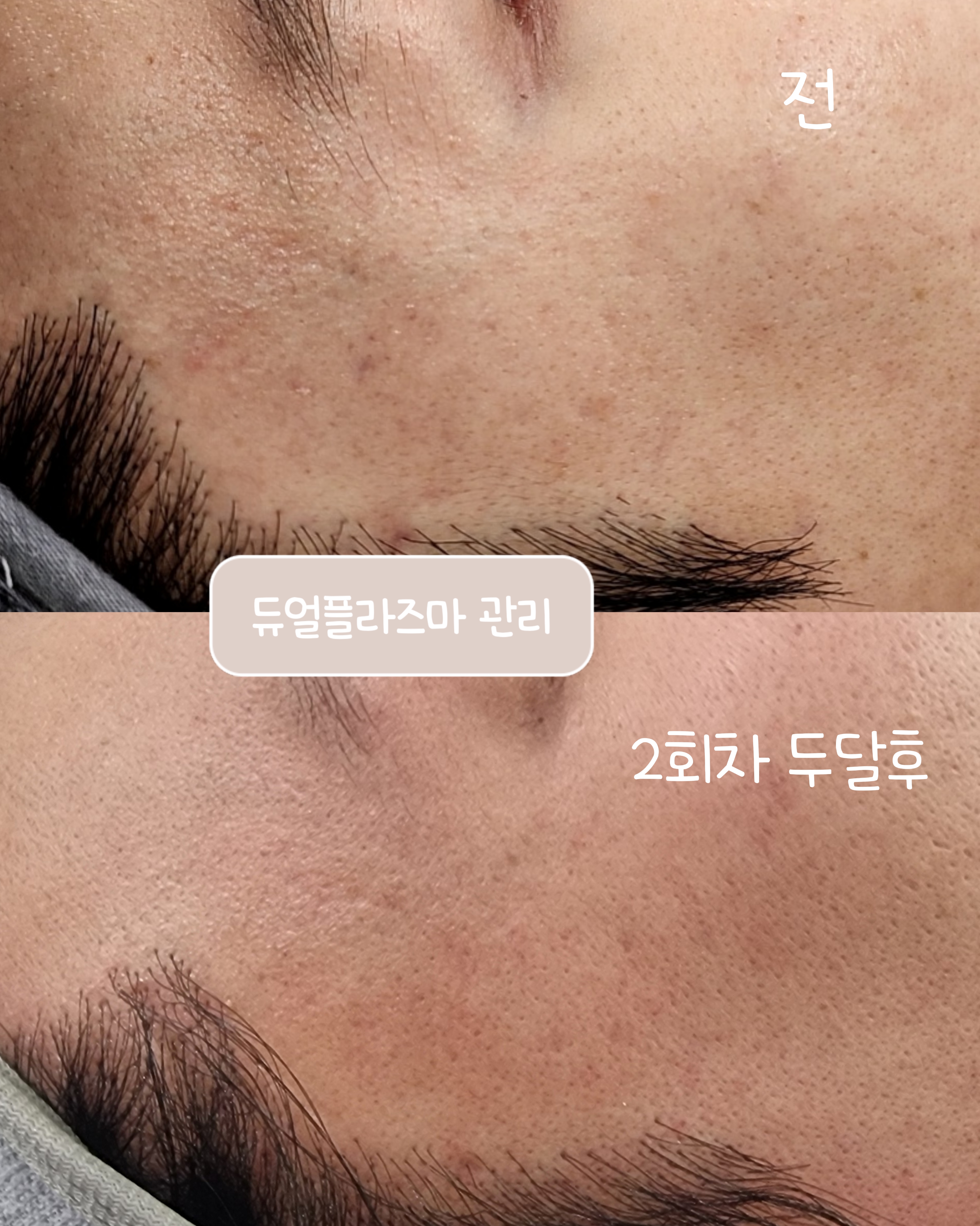 린다아이래쉬 photo 6