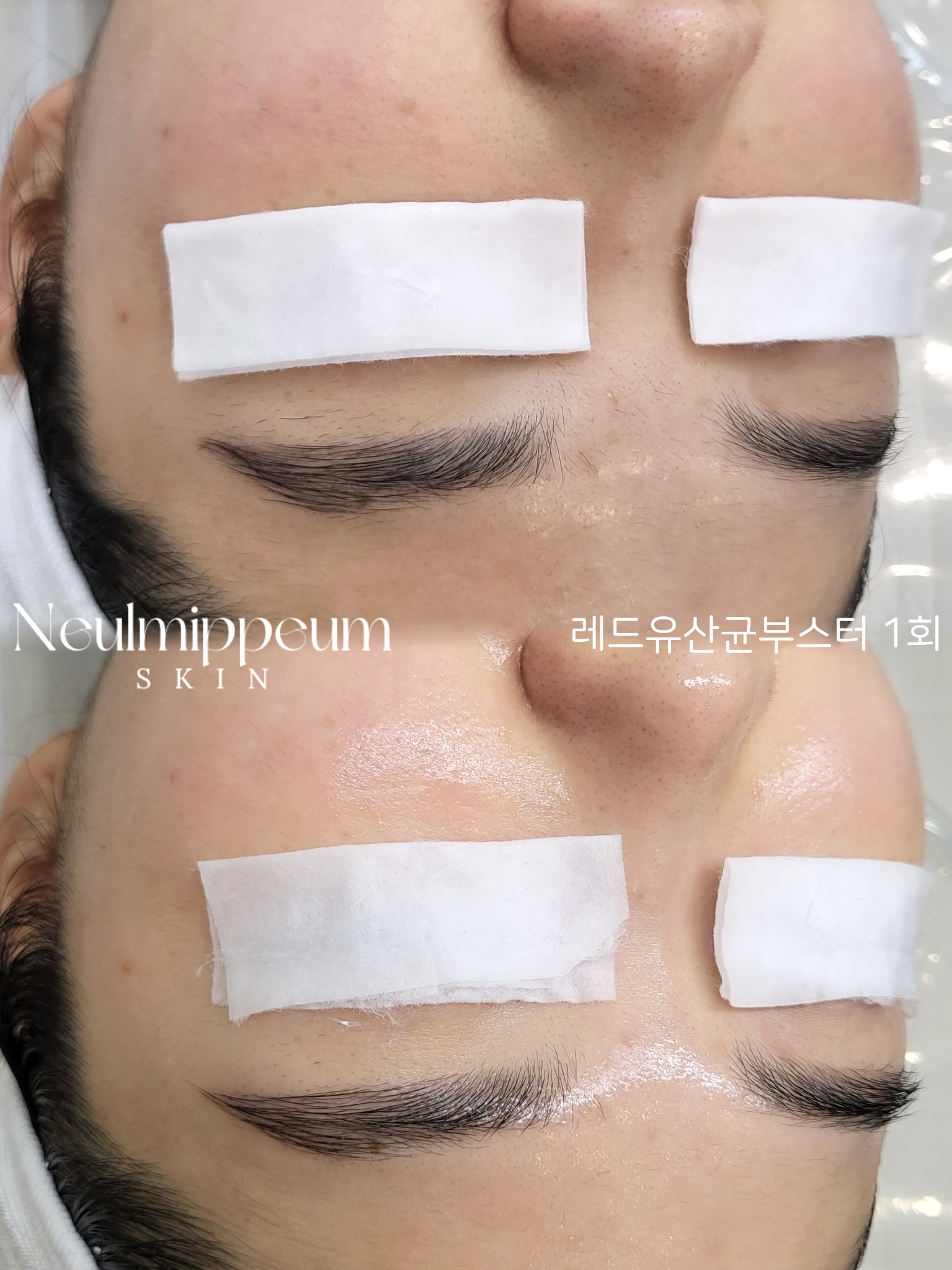 늘미쁨스킨 대표 이미지