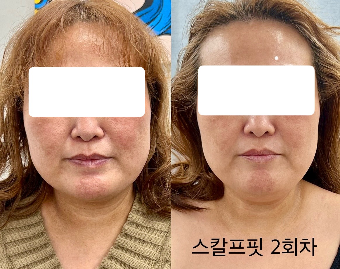 글로리뷰티 대표 이미지
