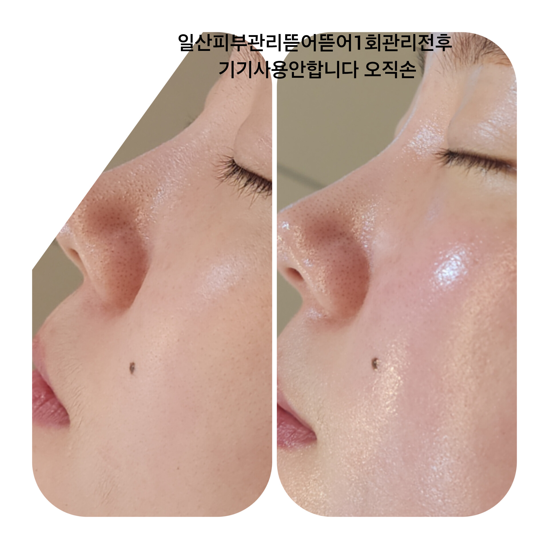 소마래디컬 by김숙 대표 이미지