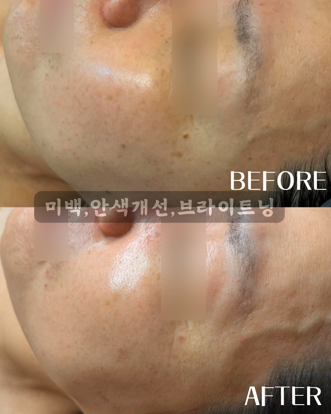 탱탱스킨바디 포항점 대표 이미지