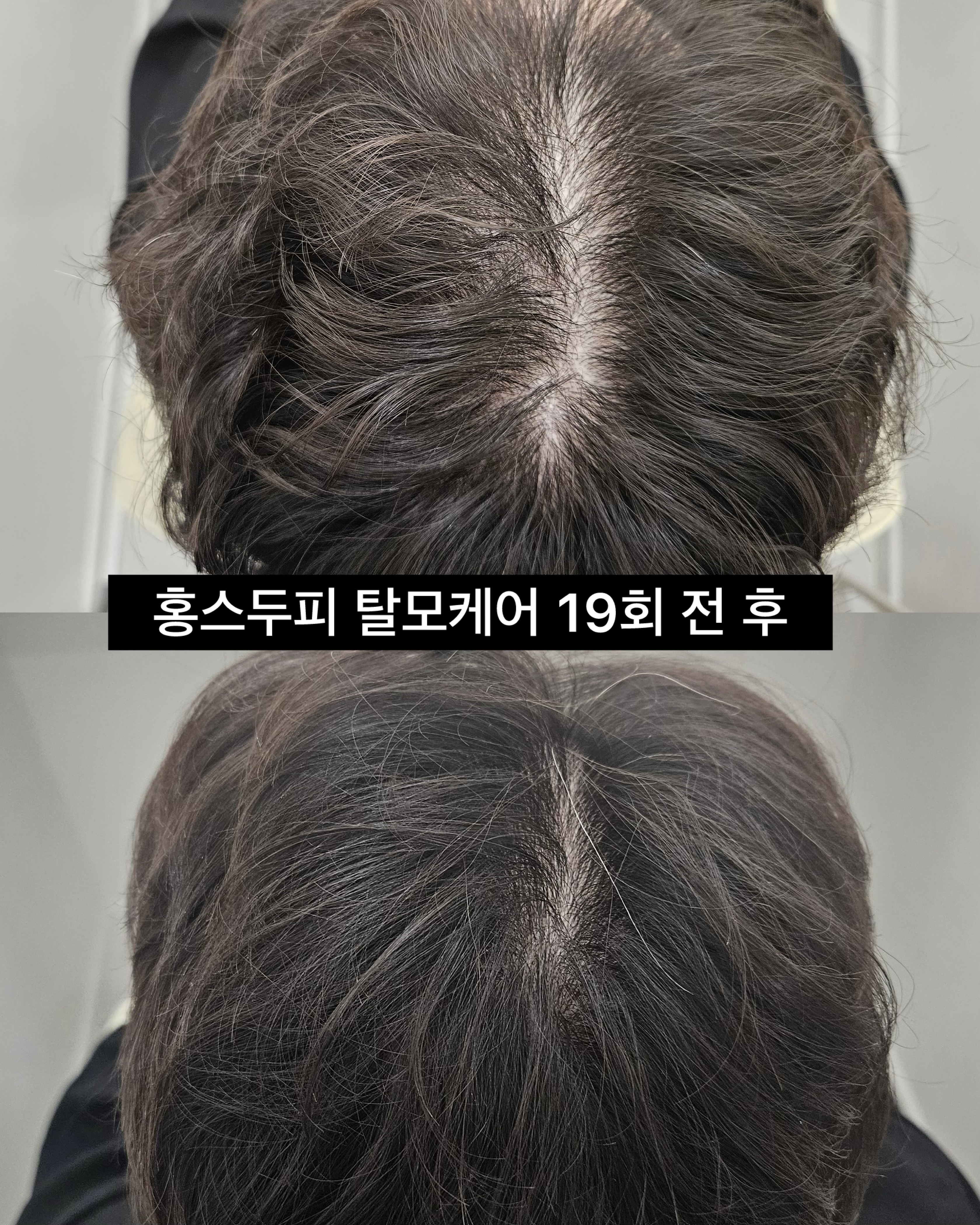 홍스두피탈모센터 대표 이미지