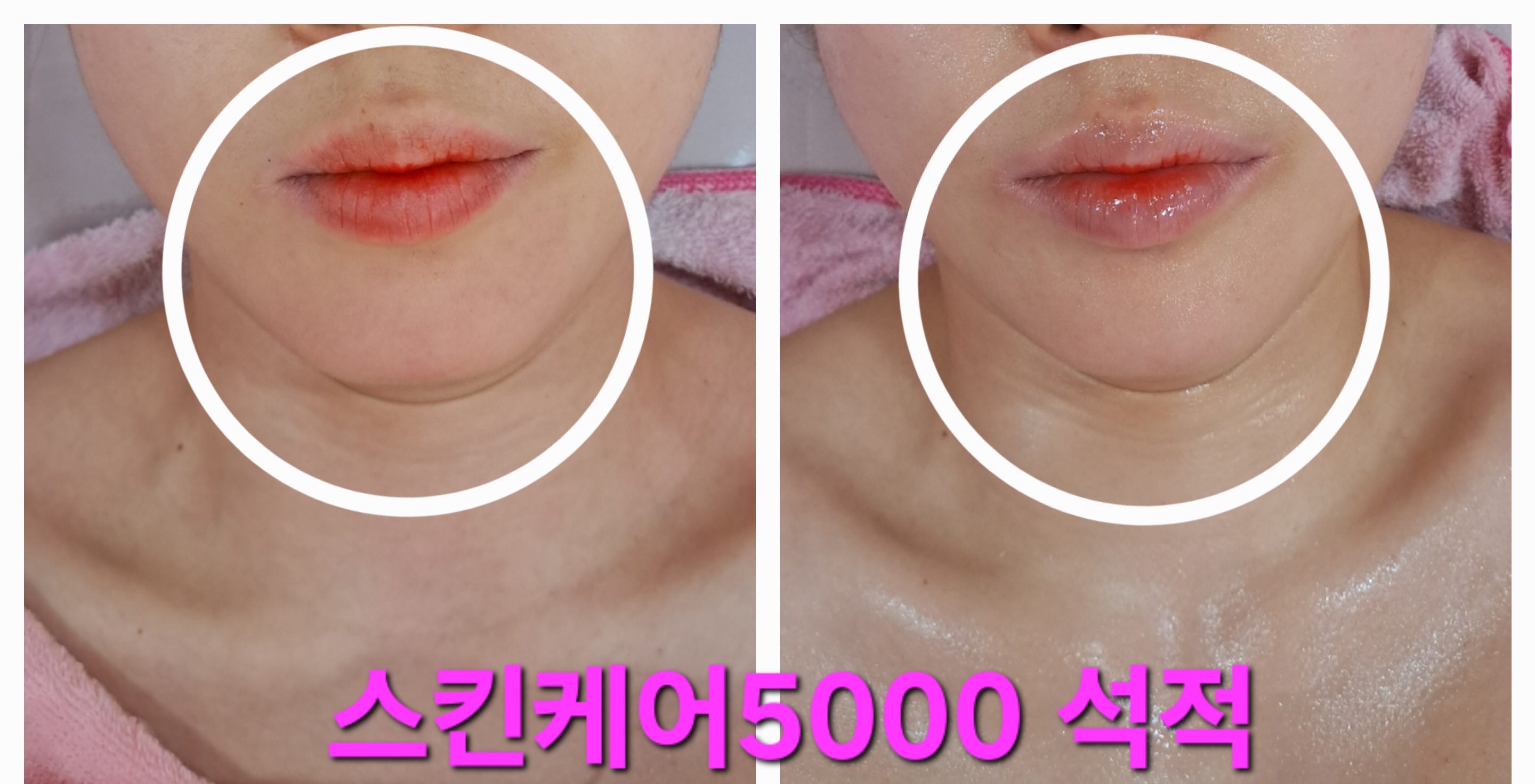 스킨케어5000