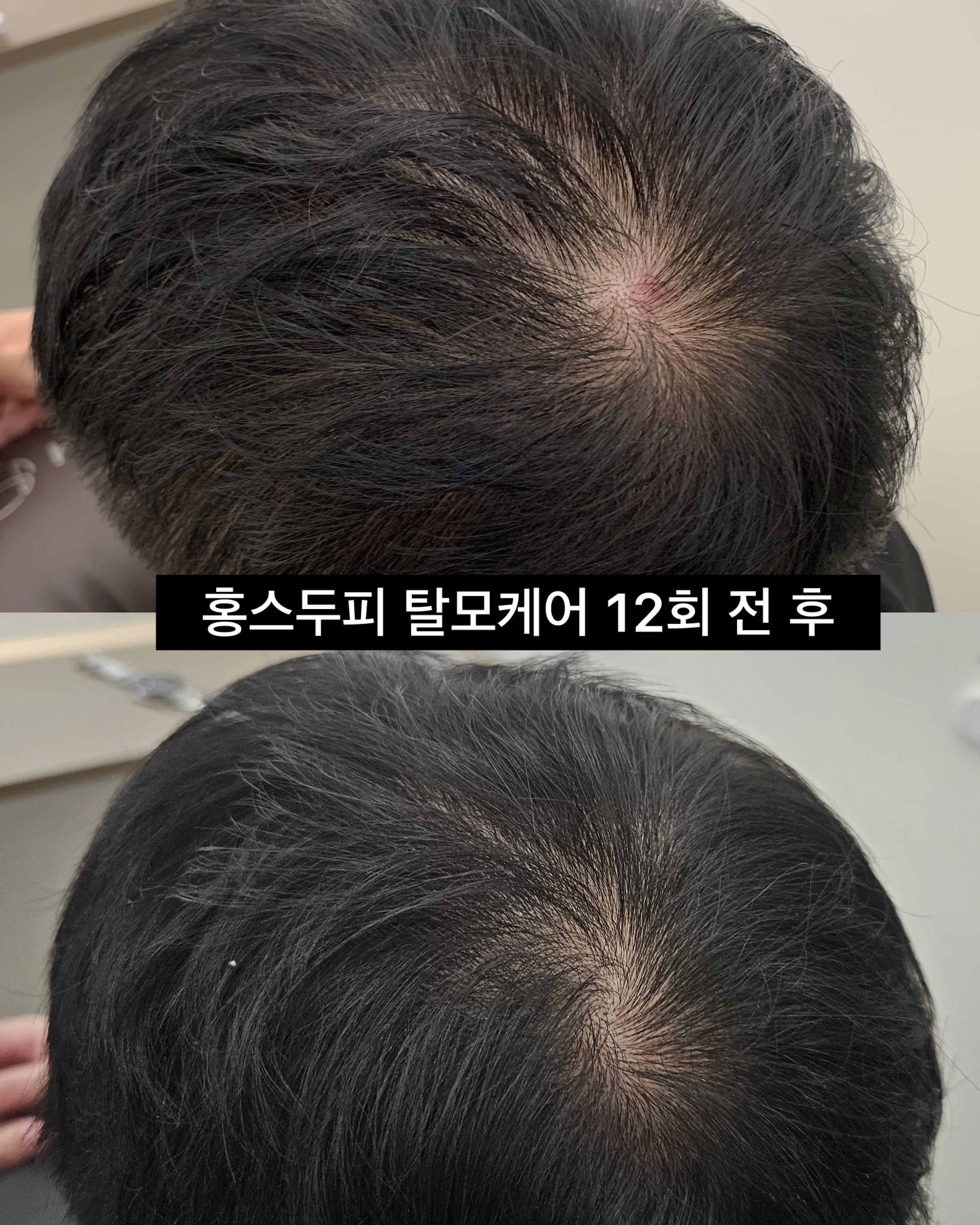 홍스두피탈모센터 대표 이미지