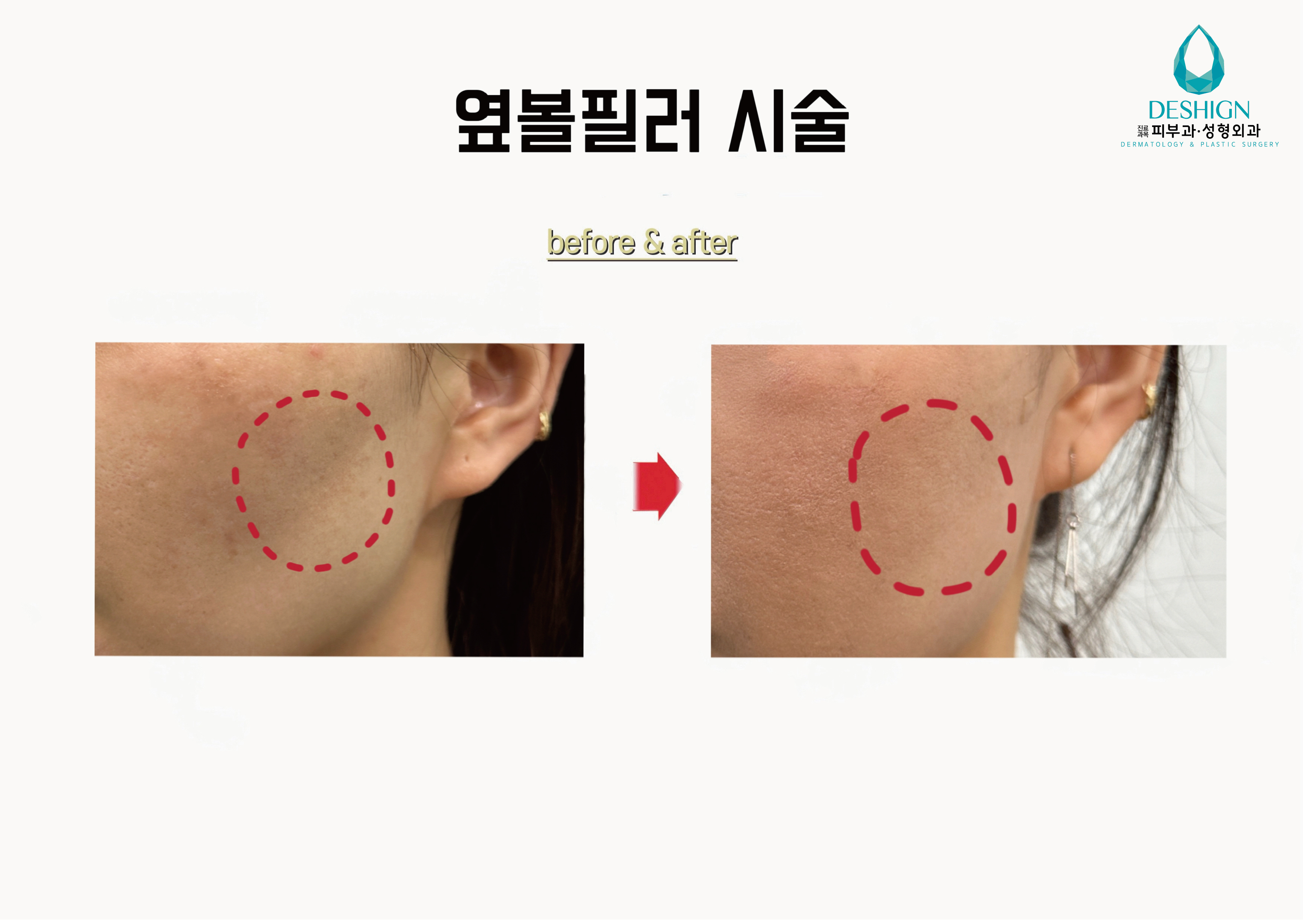 디샤인의원