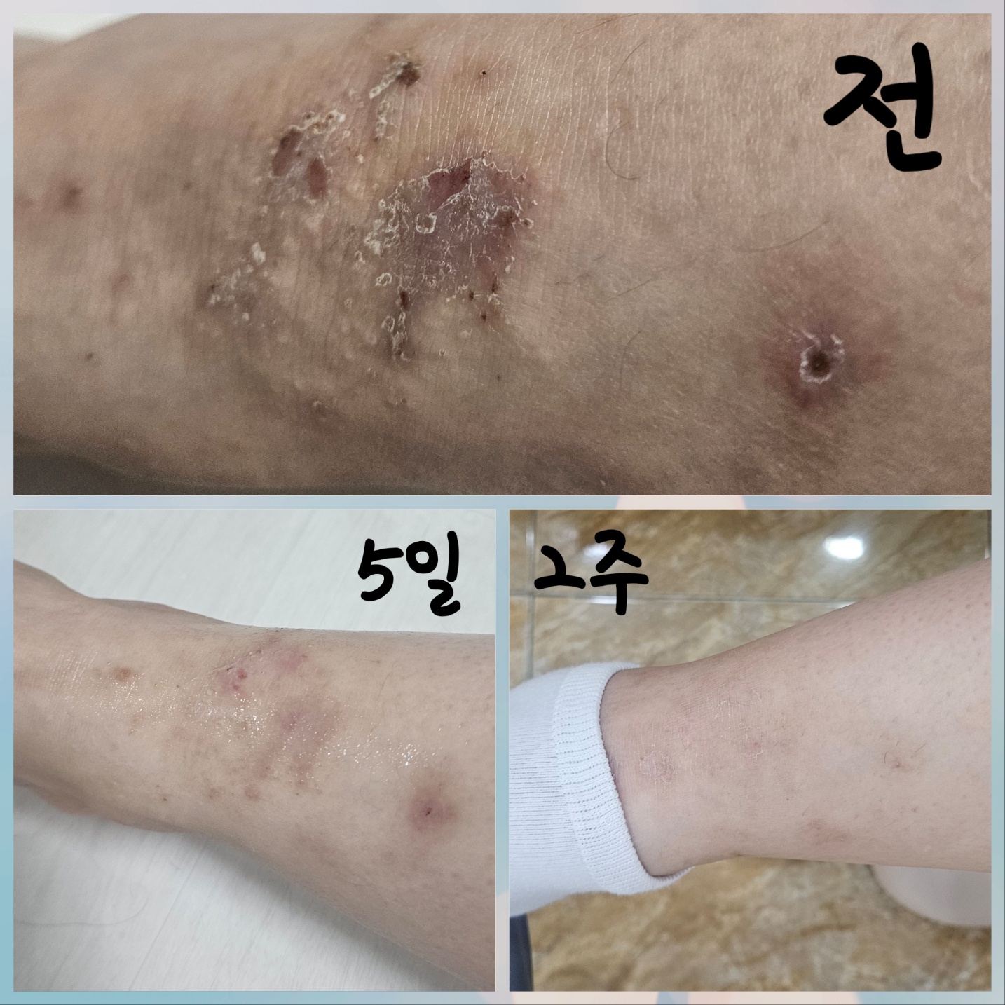 르네셀