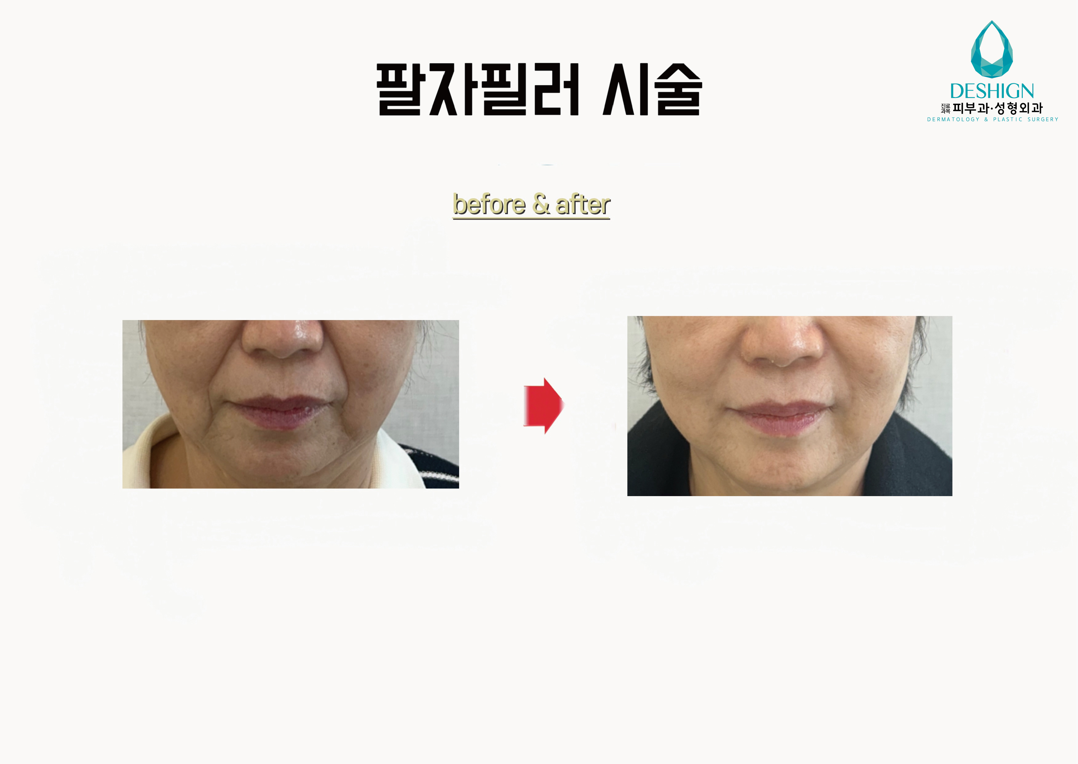 디샤인의원 대표 이미지