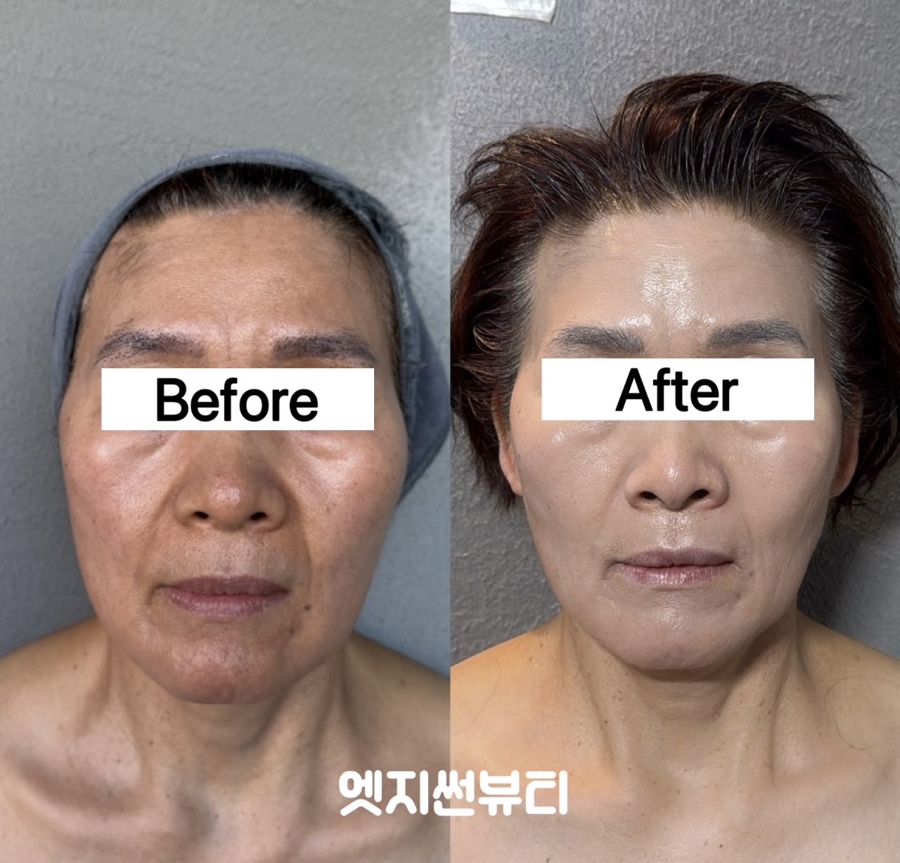 엣지썬뷰티 photo 4
