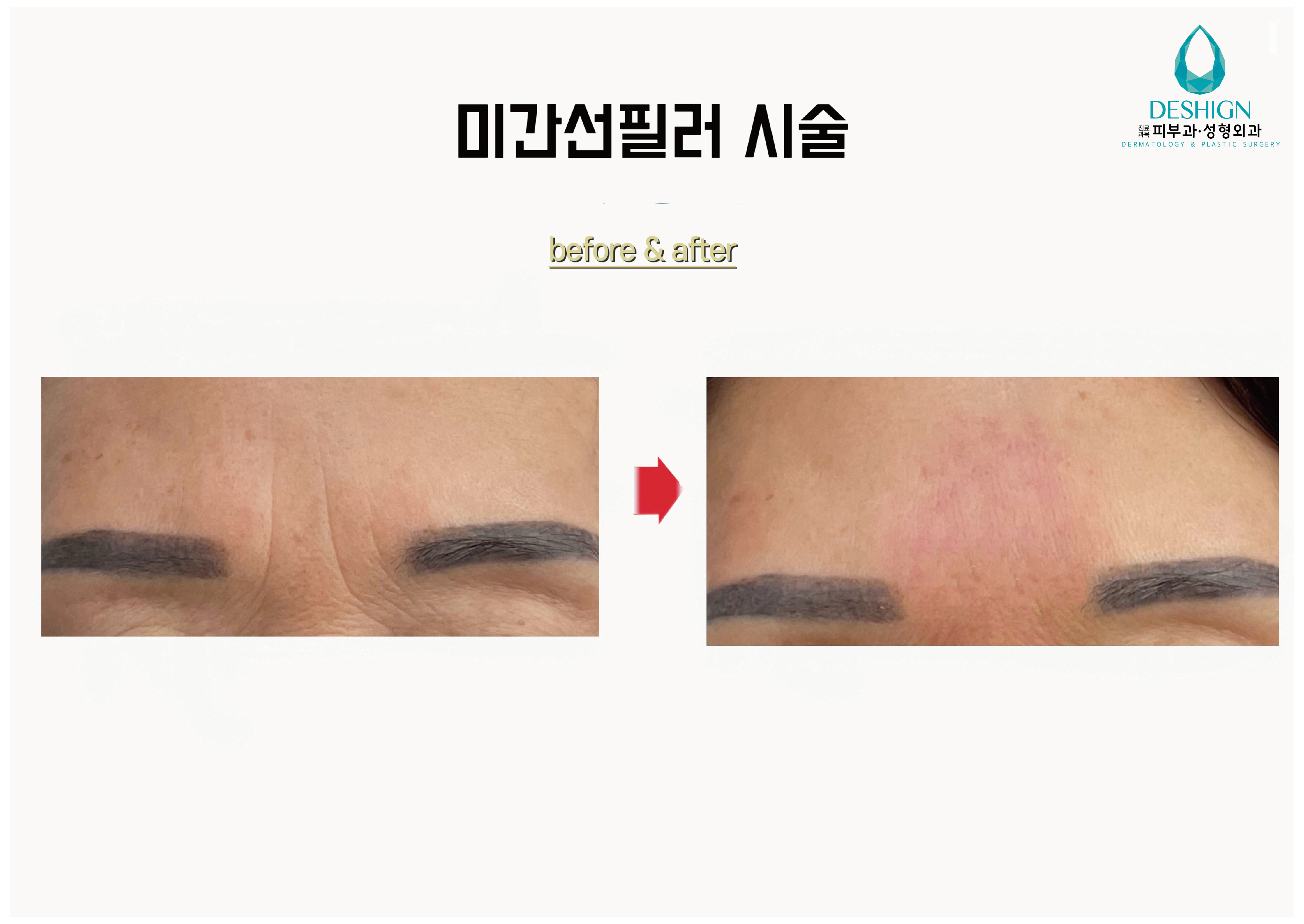 디샤인의원 대표 이미지