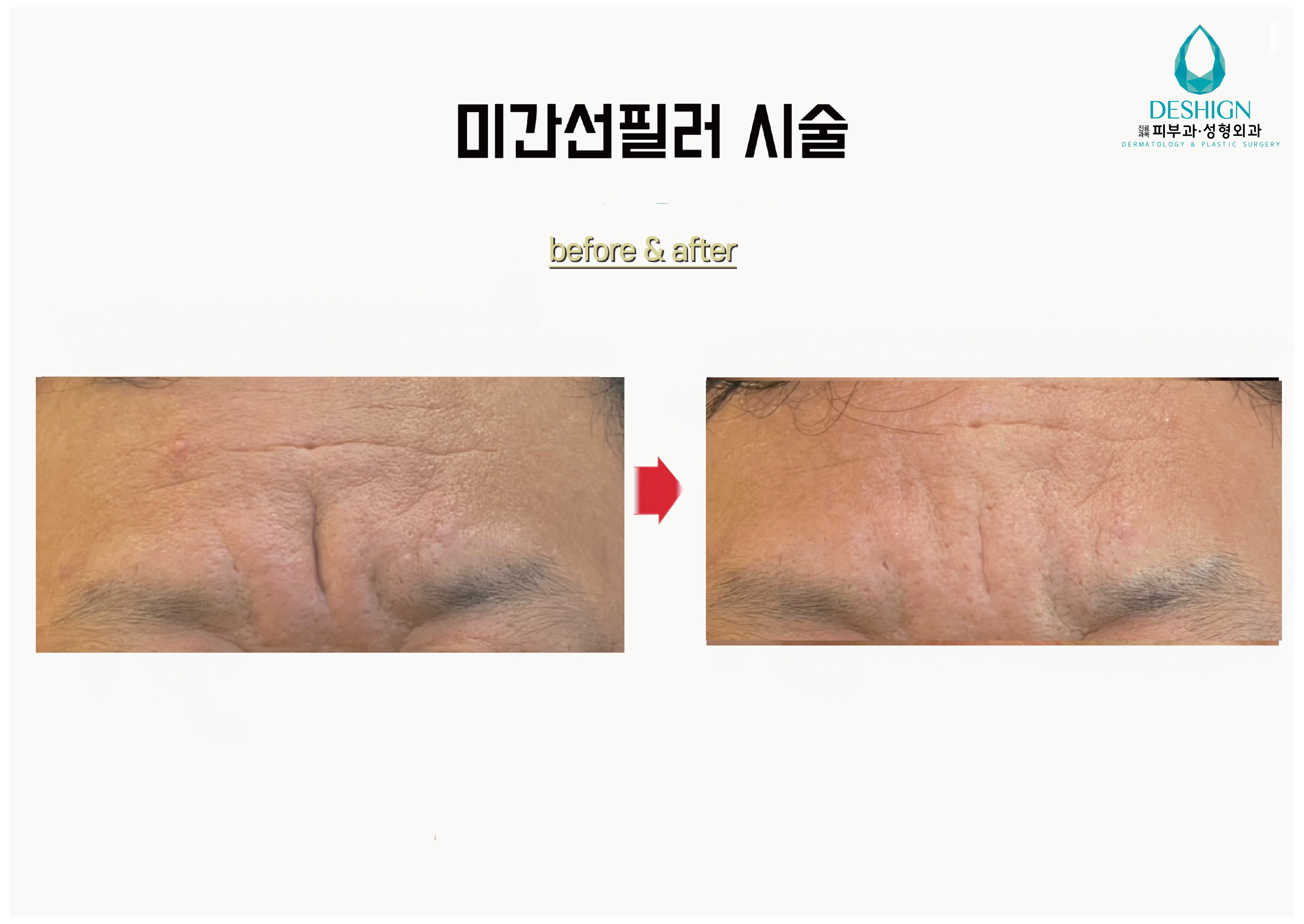 디샤인의원