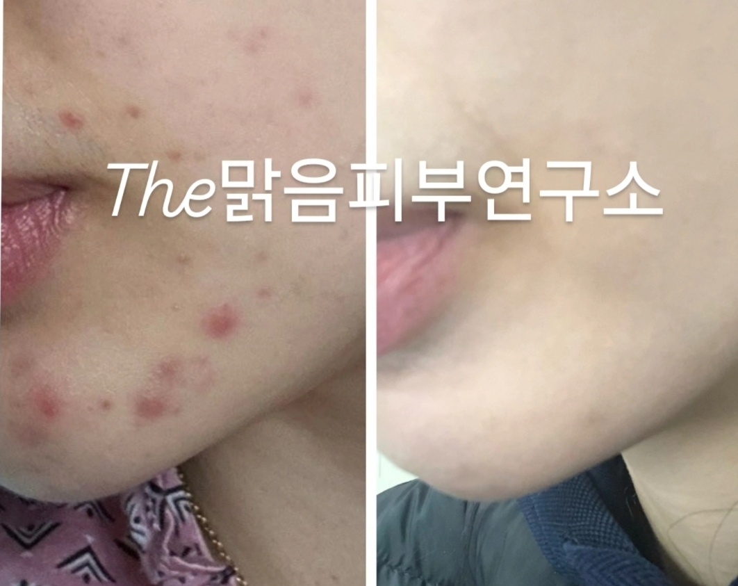 더맑음피부연구소 대표 이미지