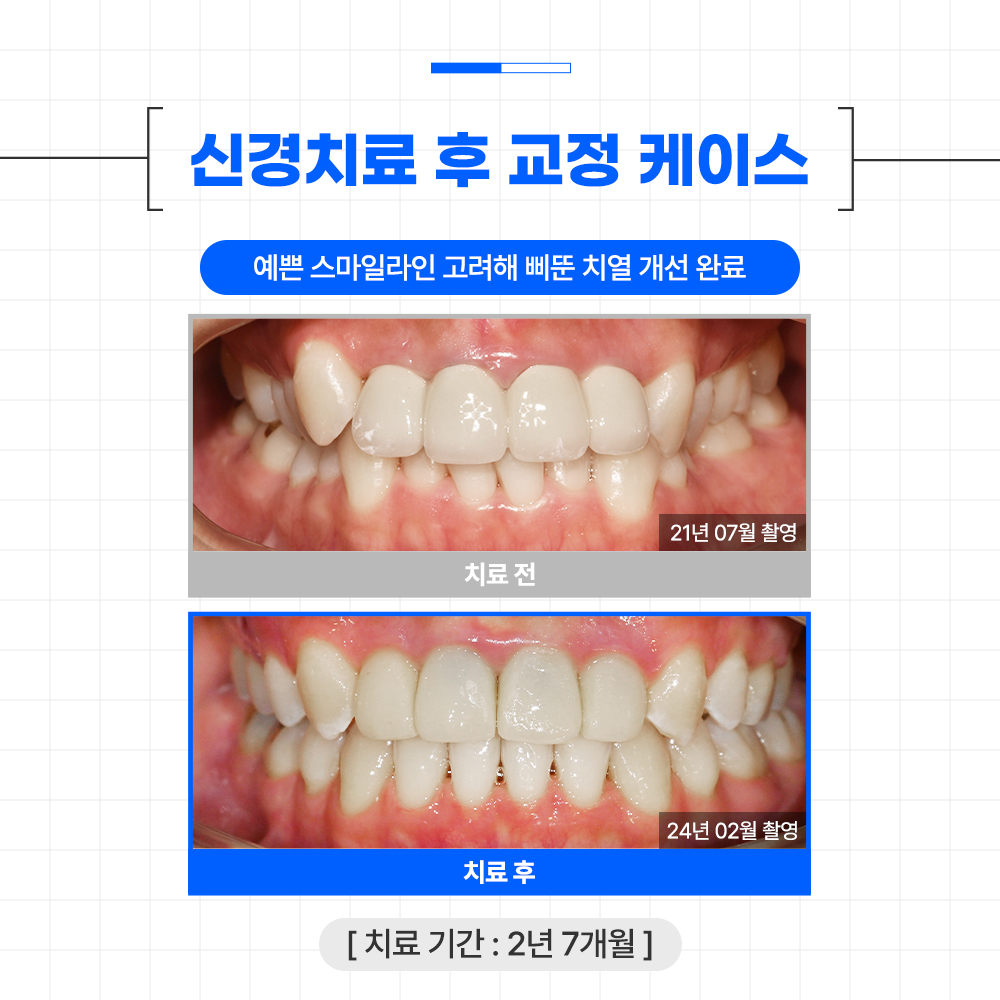 글로리치과교정과치과의원 대표 이미지