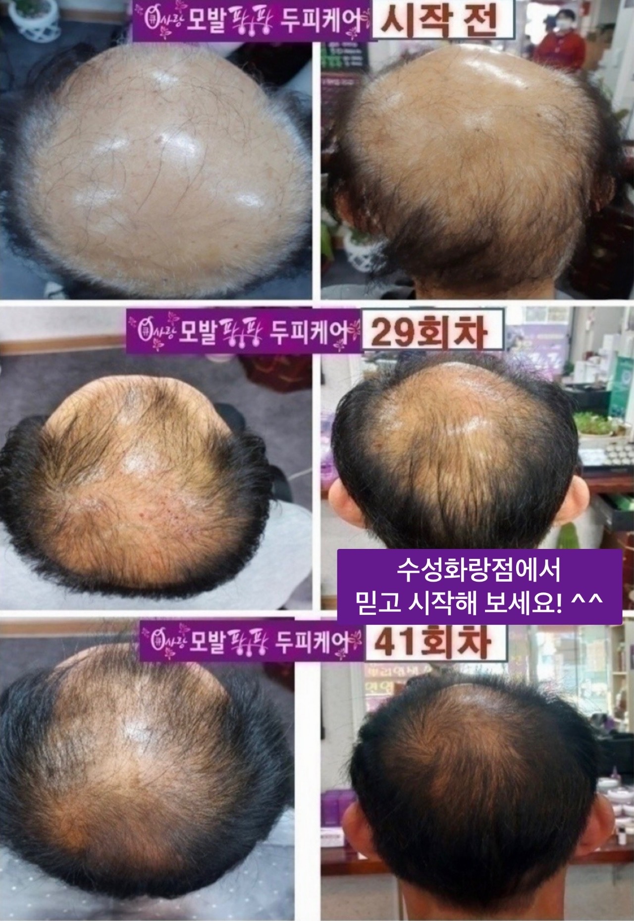 큐사랑 수성화랑점