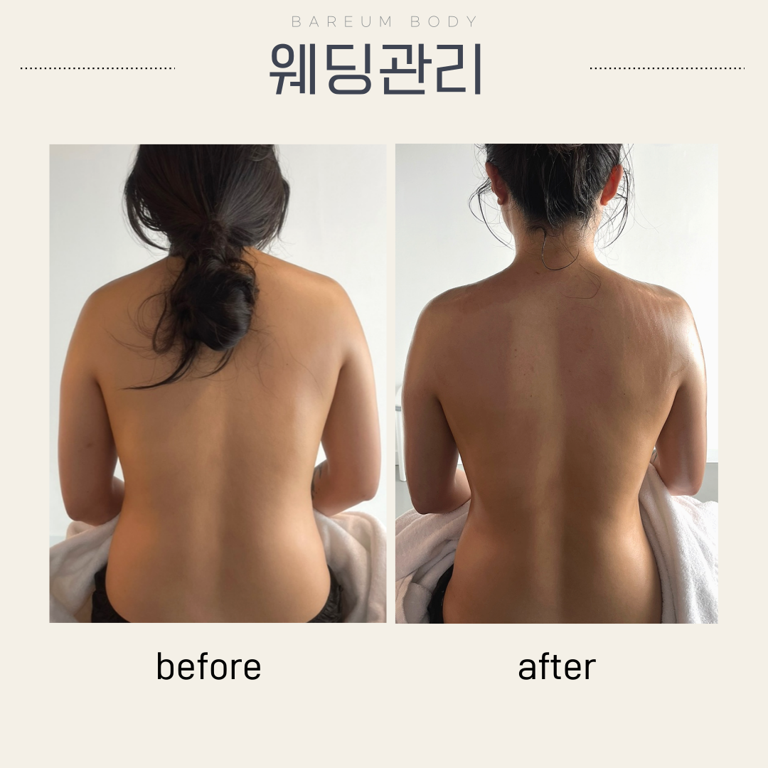 바름바디케어