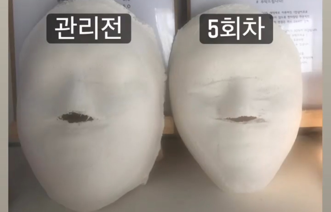 아빈에스테틱 대표 이미지