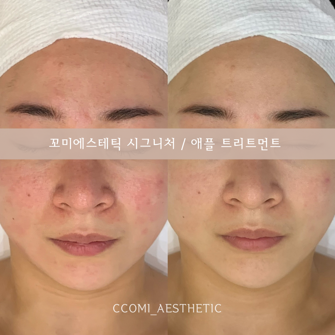 꼬미에스테틱 하남미사점