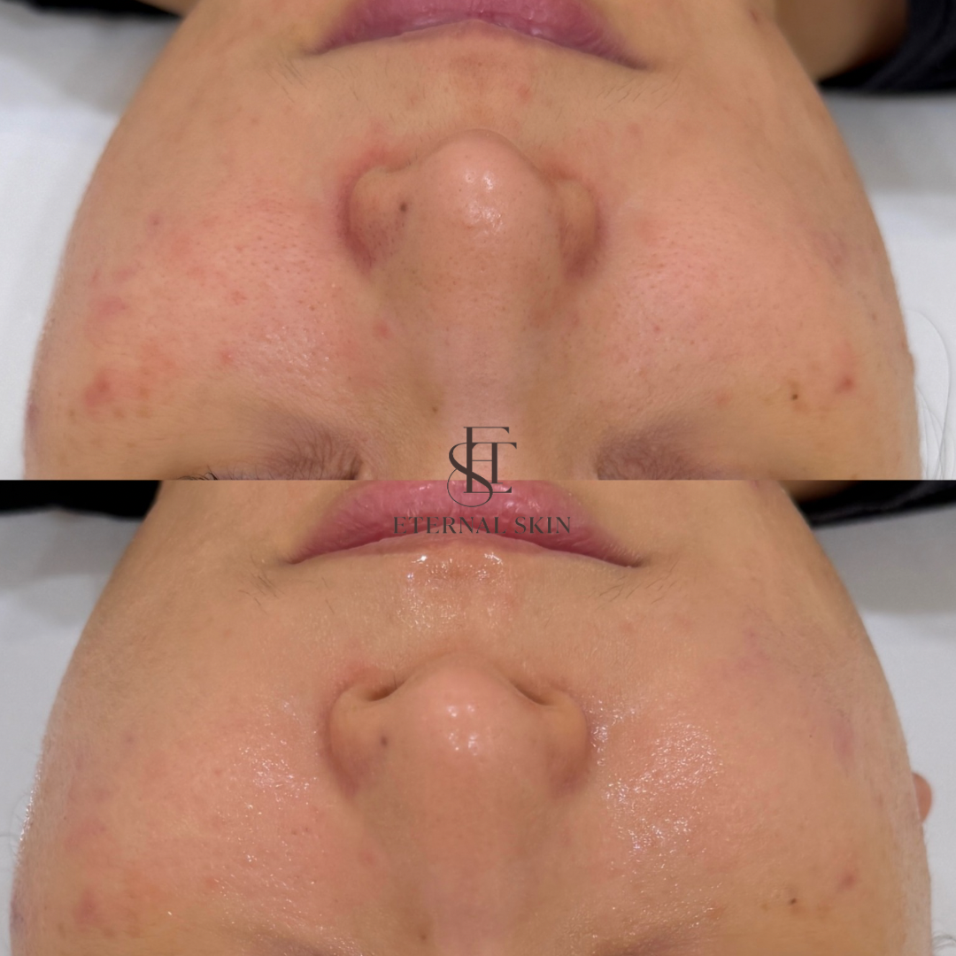 이터널스킨 대표 이미지