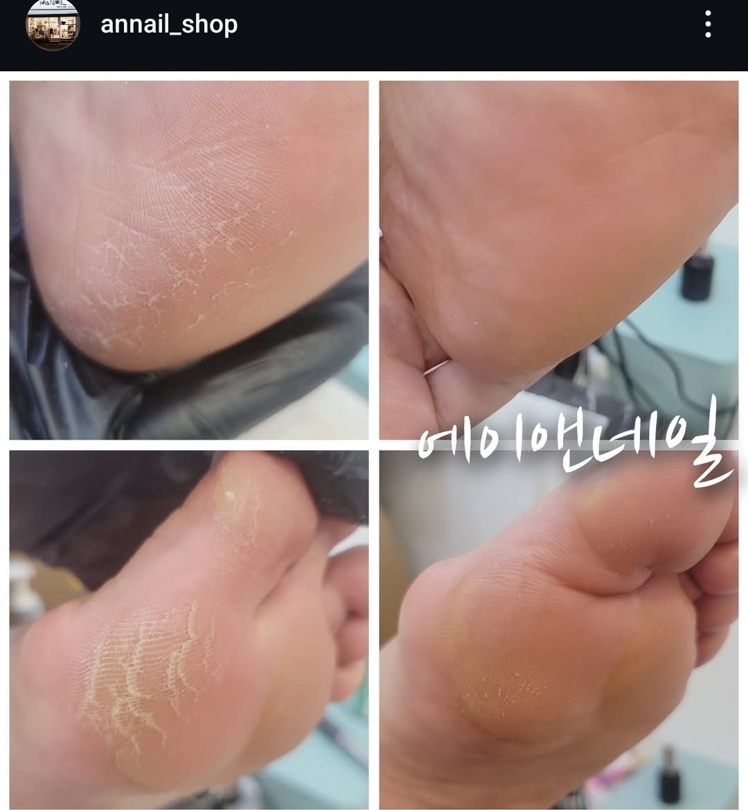 에이앤네일