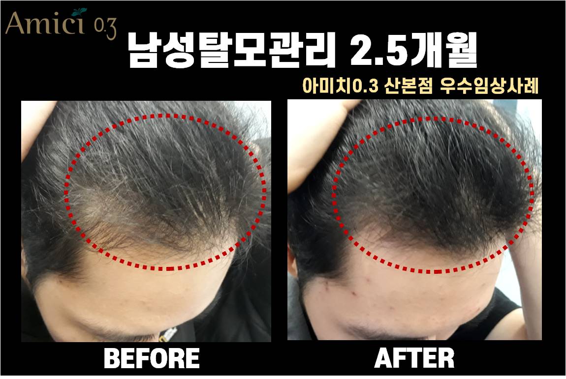 아미치0.3 산본점 대표 이미지