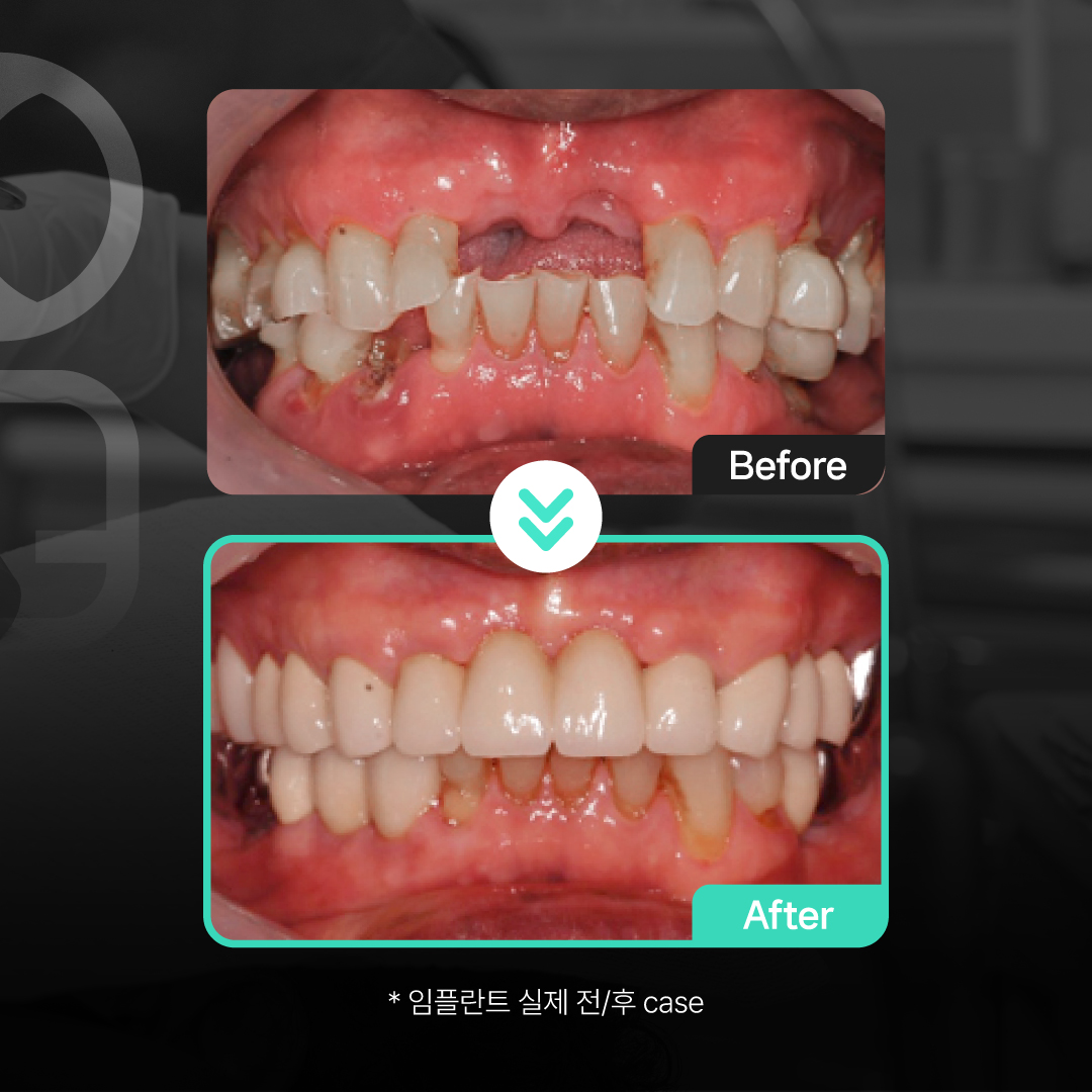 마음으로치과의원 중구 대표 이미지