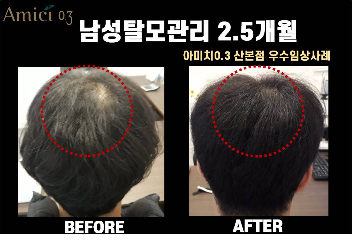 아미치0.3 산본점 대표 이미지