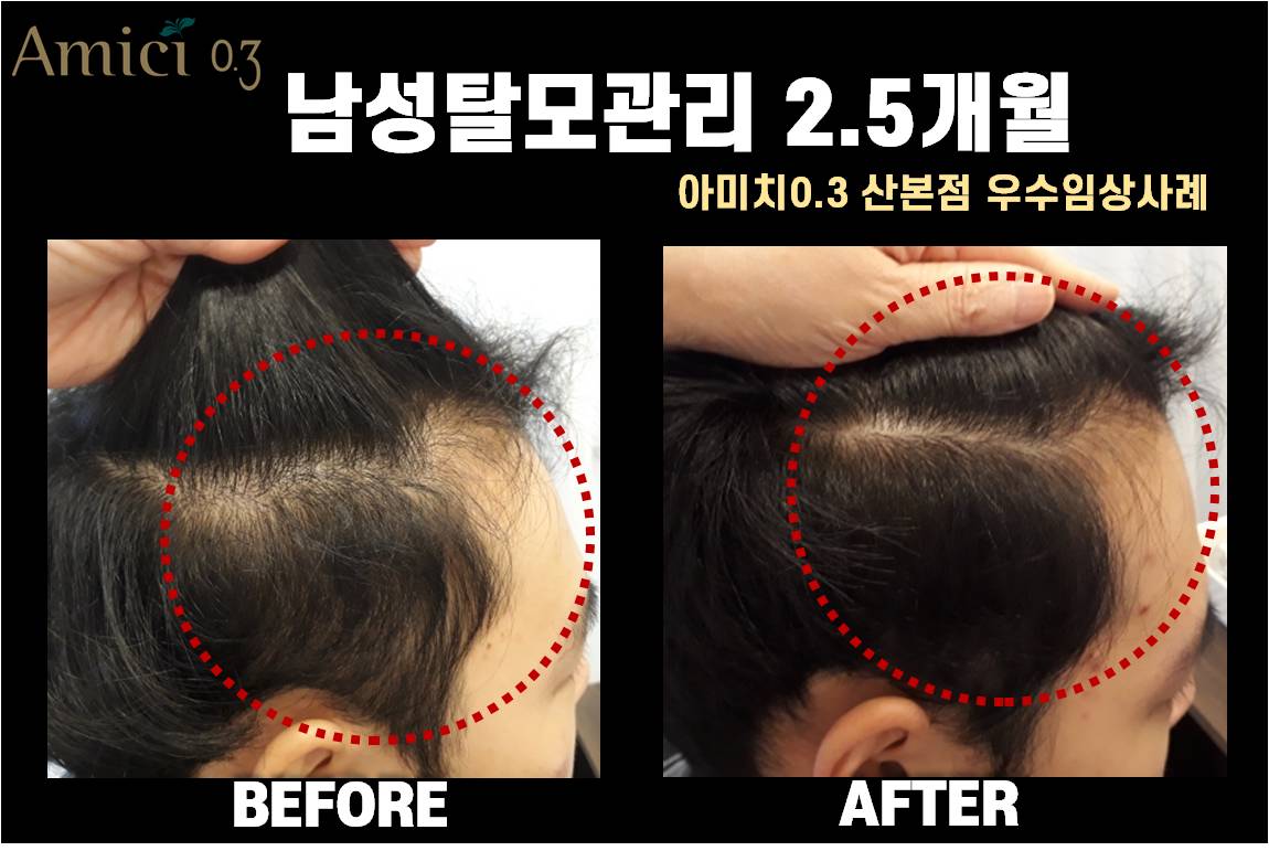 아미치0.3 산본점 대표 이미지