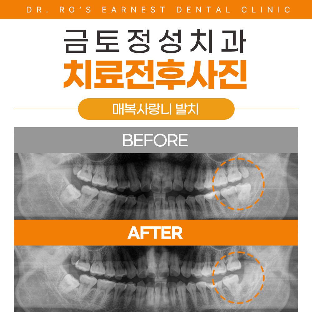 금토정성치과의원 대표 이미지