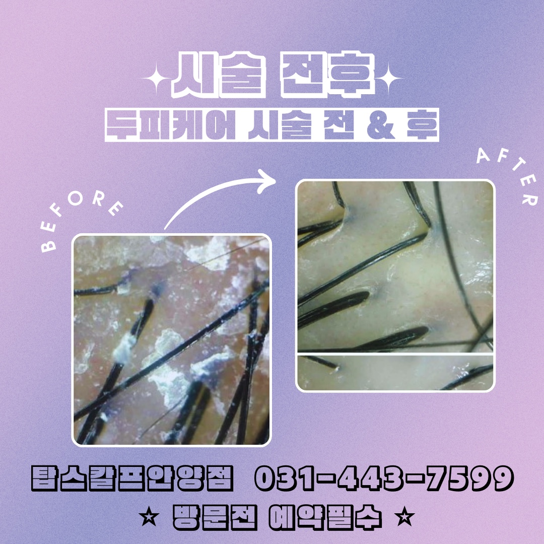 탑스칼프 안양점 대표 이미지