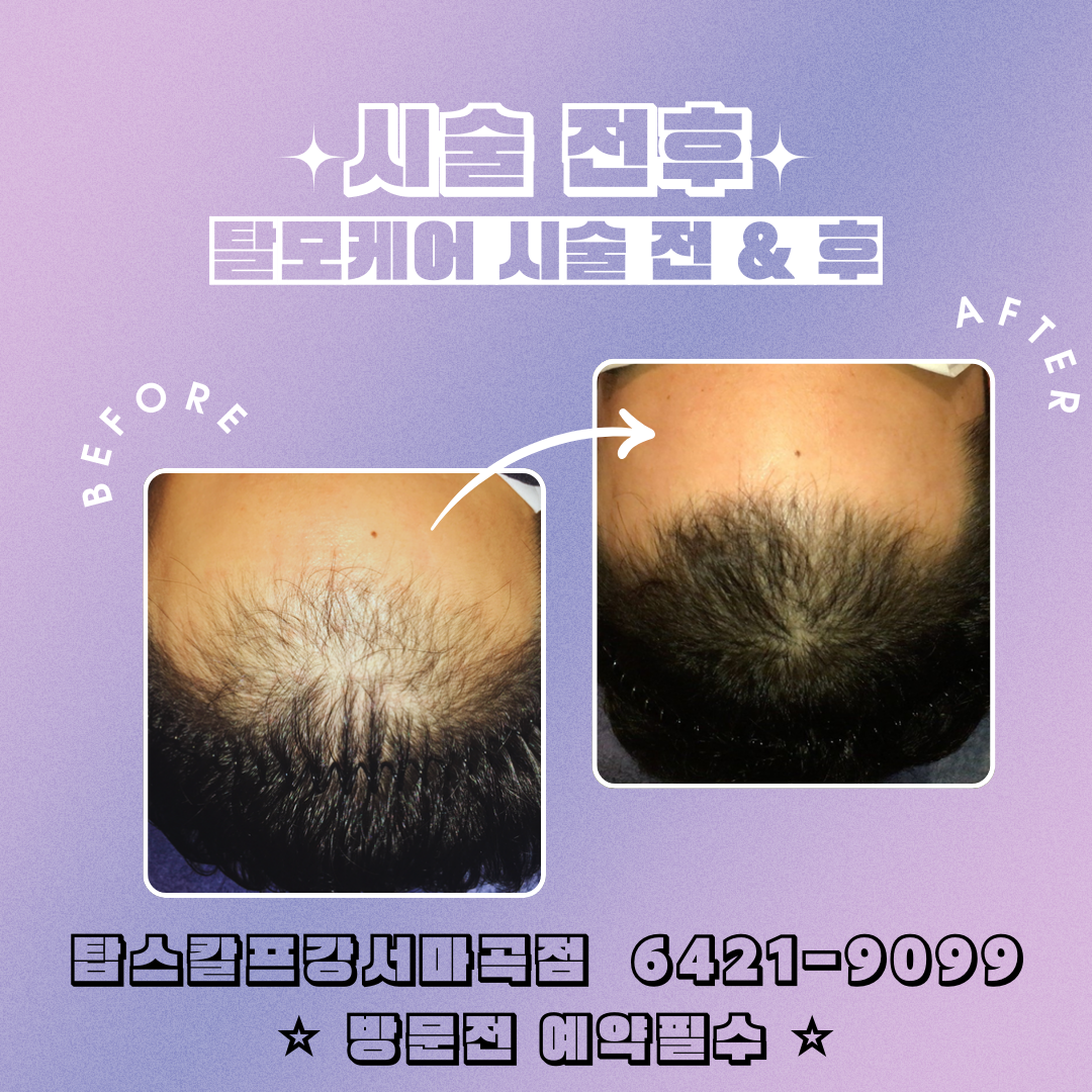 탑스칼프 강서마곡점 대표 이미지