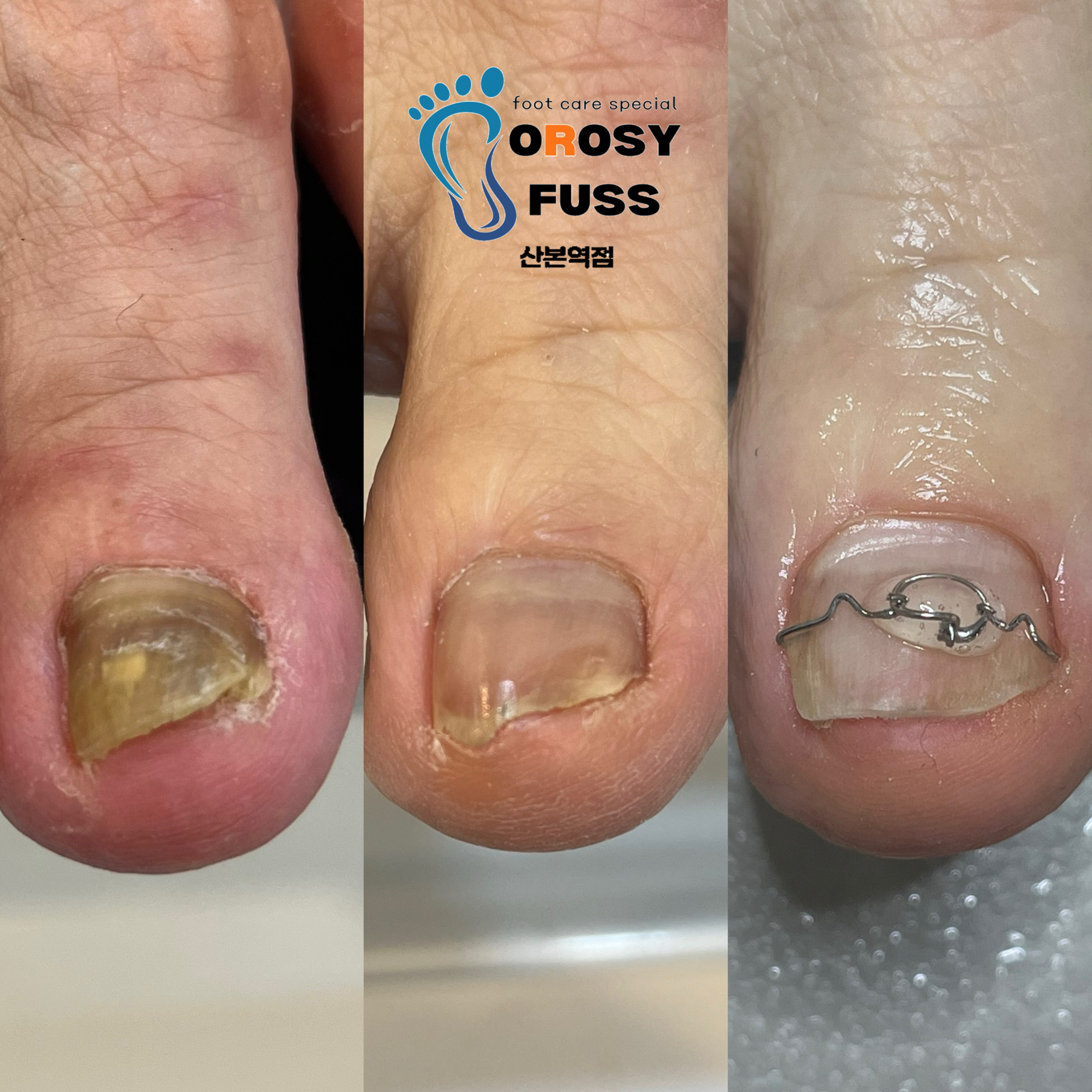 리스네일N속눈썹 오로지푸스 산본역점 대표 이미지