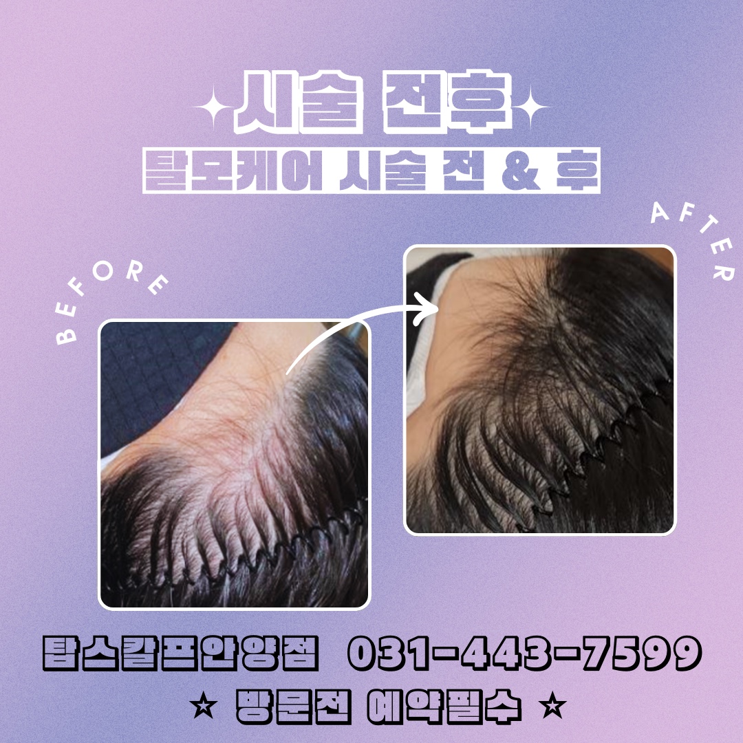 탑스칼프 안양점 대표 이미지