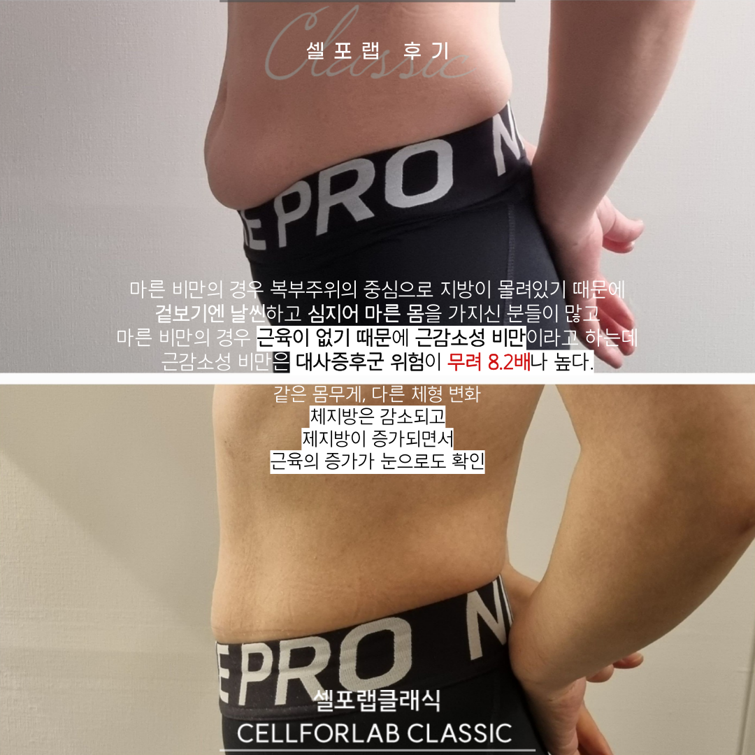 에스라인테라피 셀포랩아우름