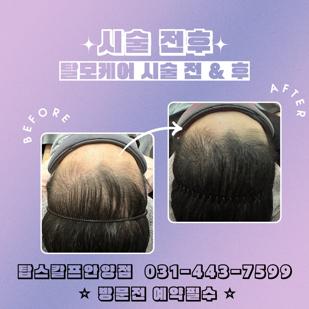 탑스칼프 안양점 대표 이미지