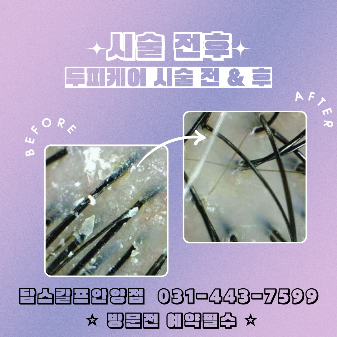 탑스칼프 안양점 대표 이미지