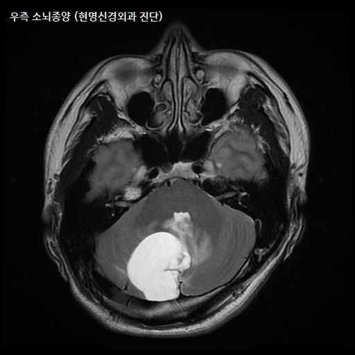 현명신경외과의원