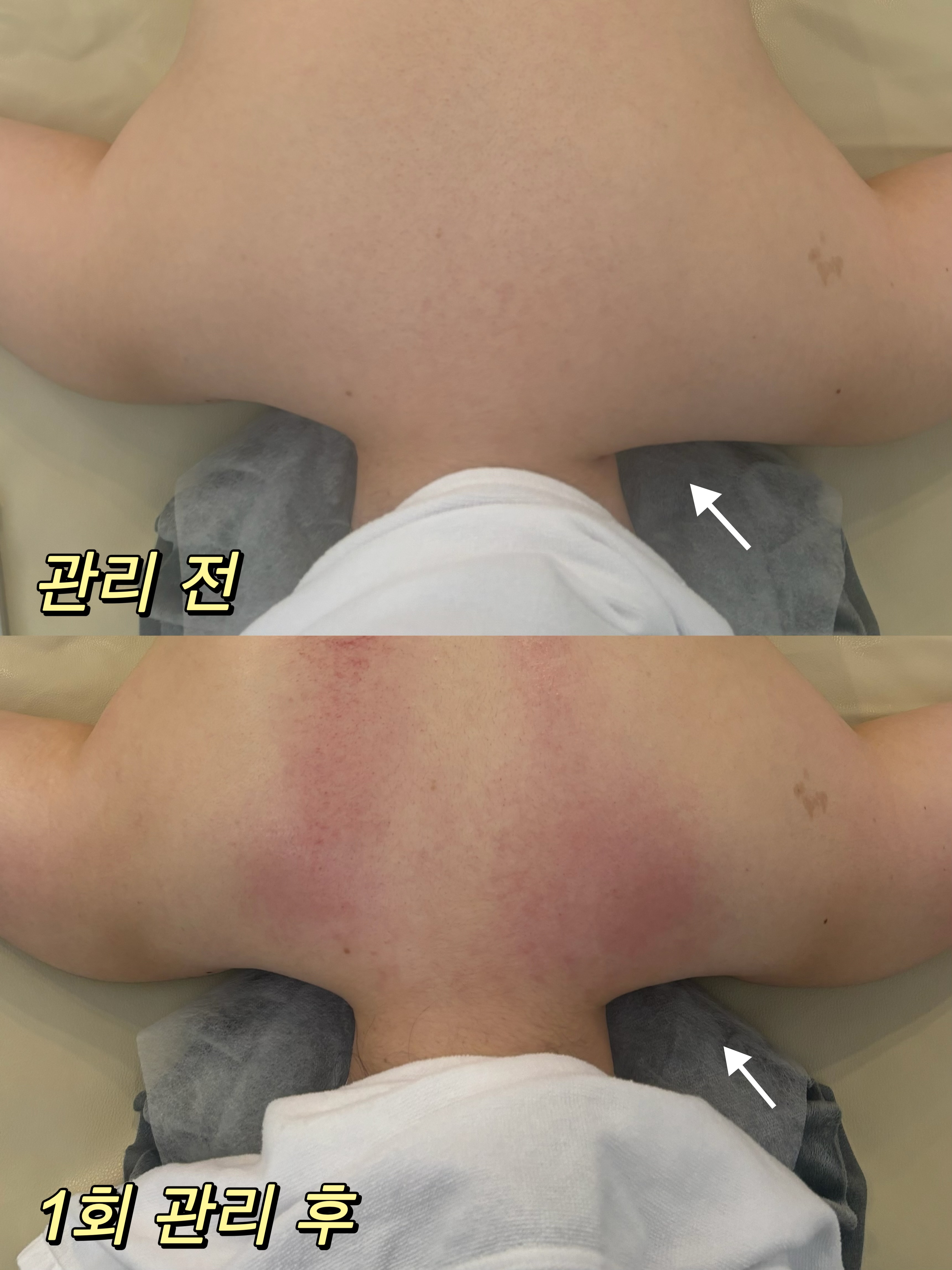 이프로움 대표 이미지