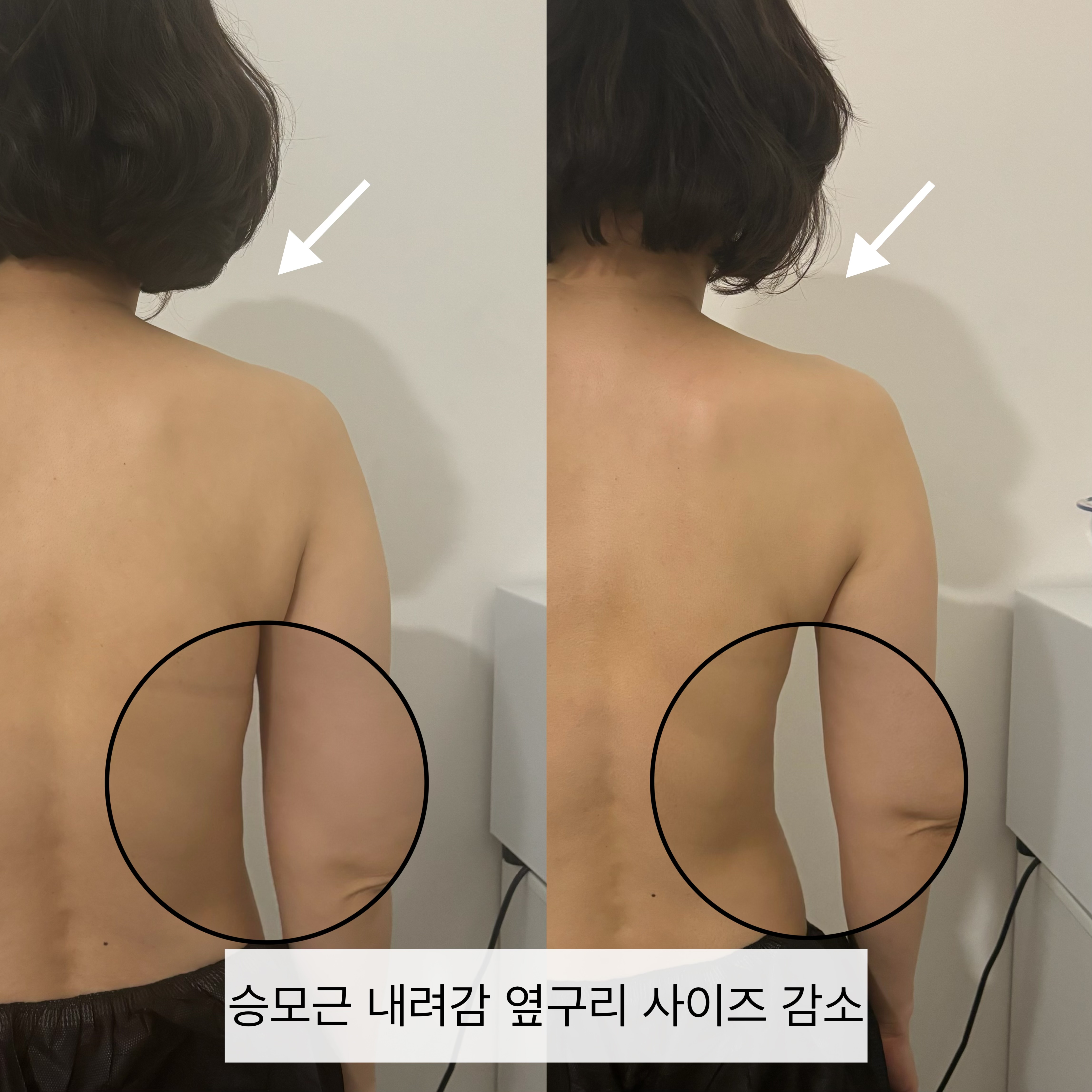 이프로움 photo 3