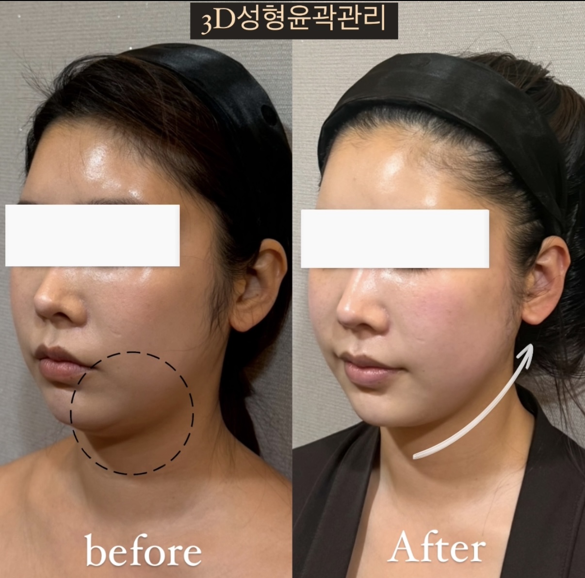 포미뷰티센터 대표 이미지